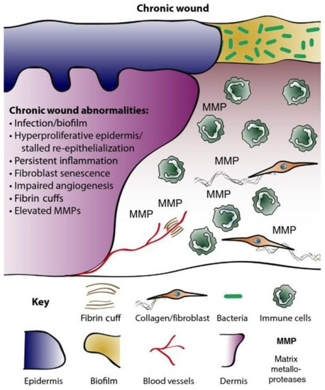Antibiotics-Free Compounds for Chronic Wound Healing