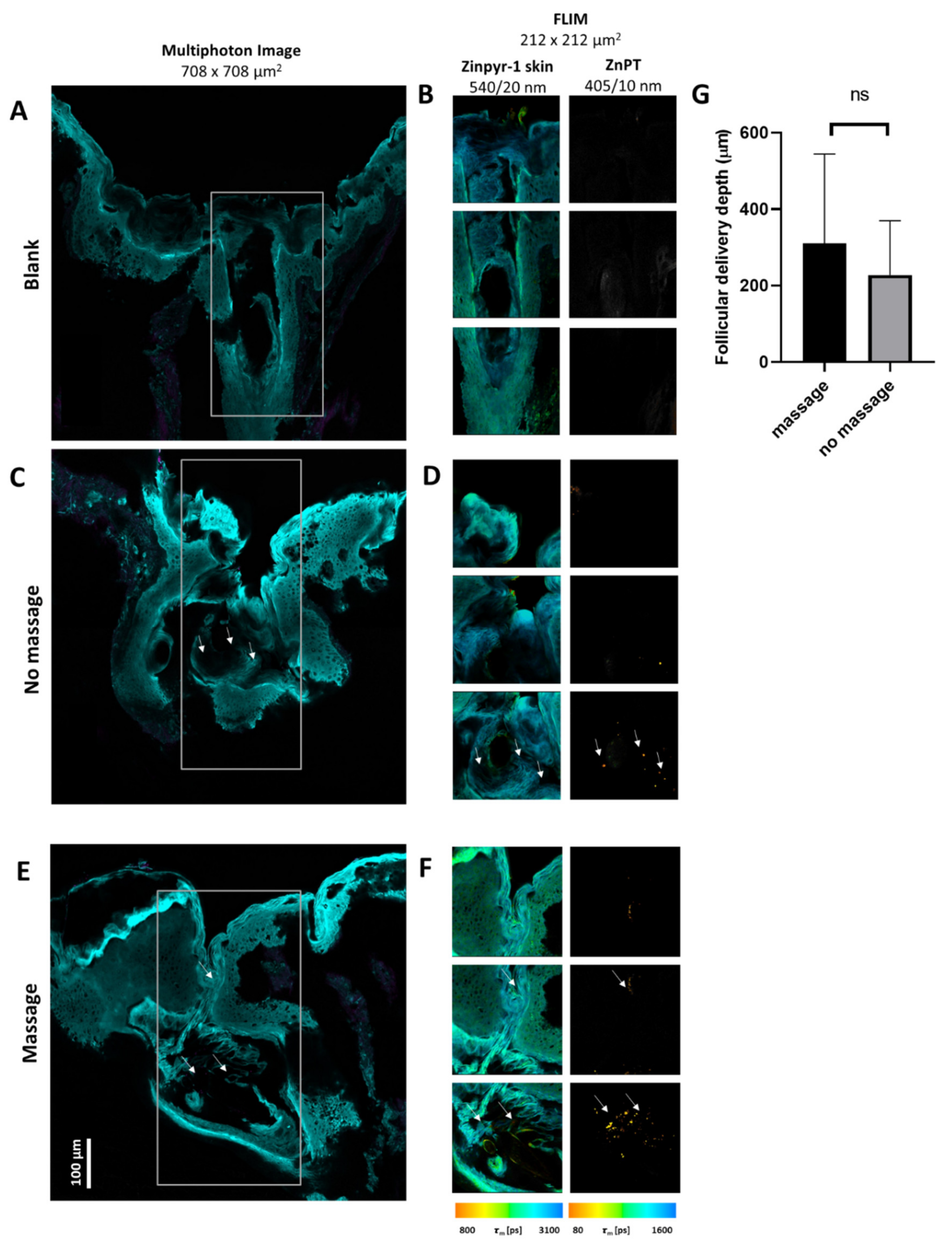 Pharmaceutics 14 01076 g003