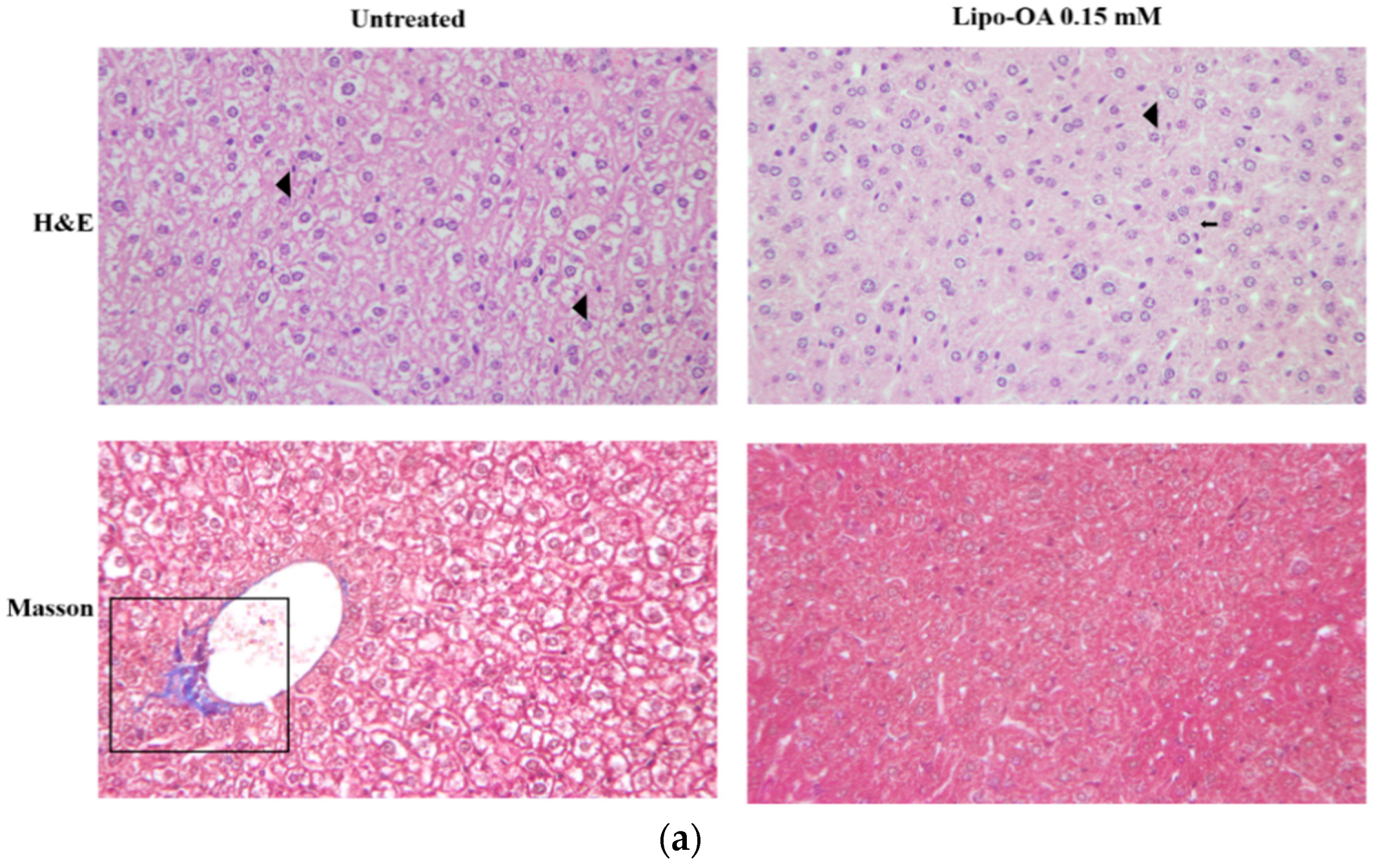 Pharmaceutics 14 01108 g006a