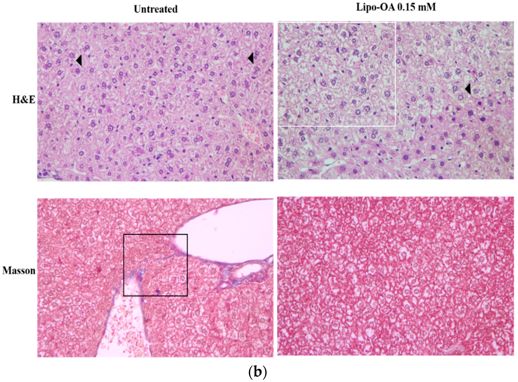 Pharmaceutics 14 01108 g006b