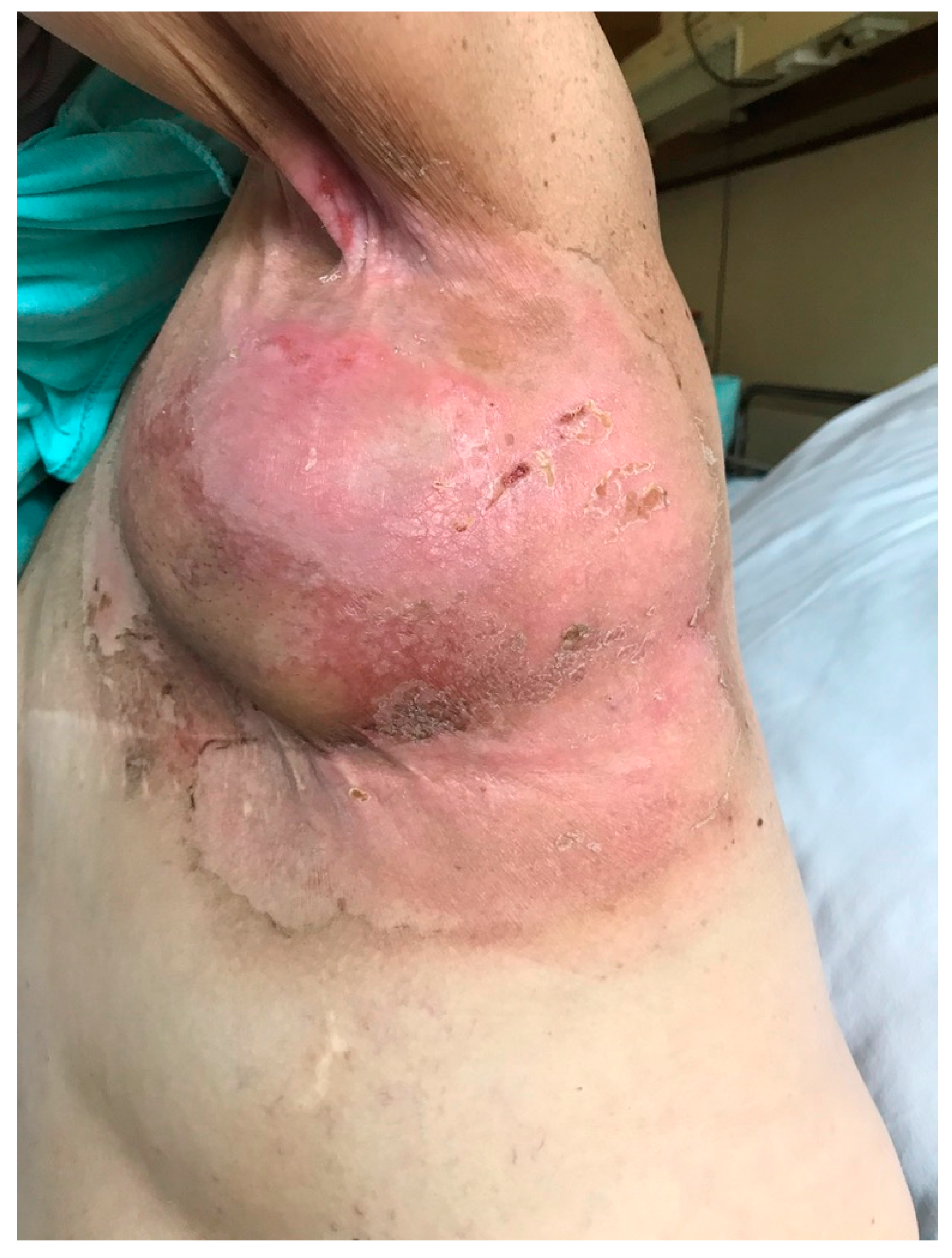 Pharmaceutics 14 01204 g001