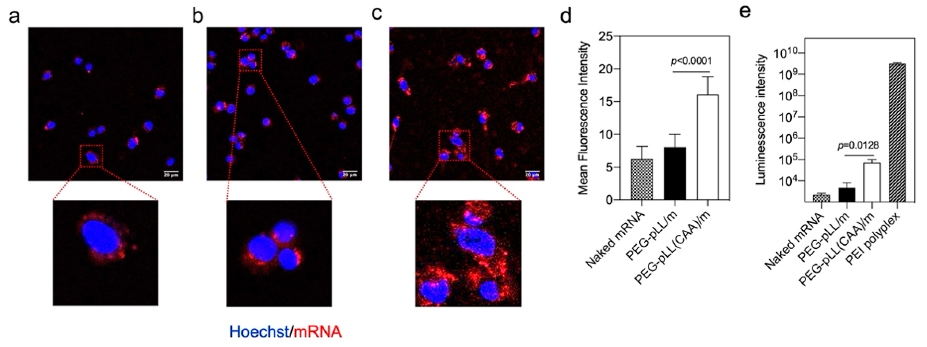 Label each structure in the diagram of mrna processing