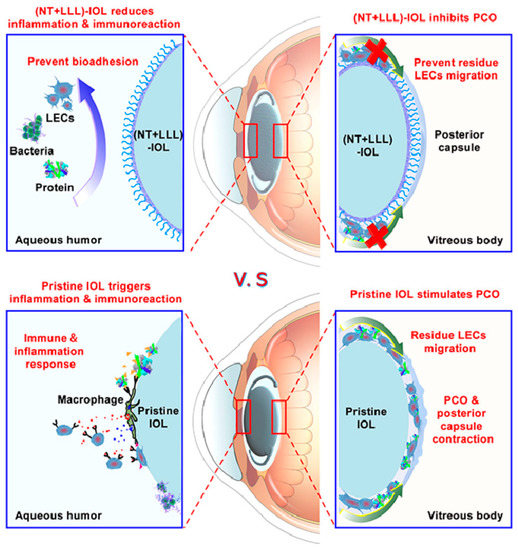 Research Progress Concerning a Novel Intraocular Lens for the ...