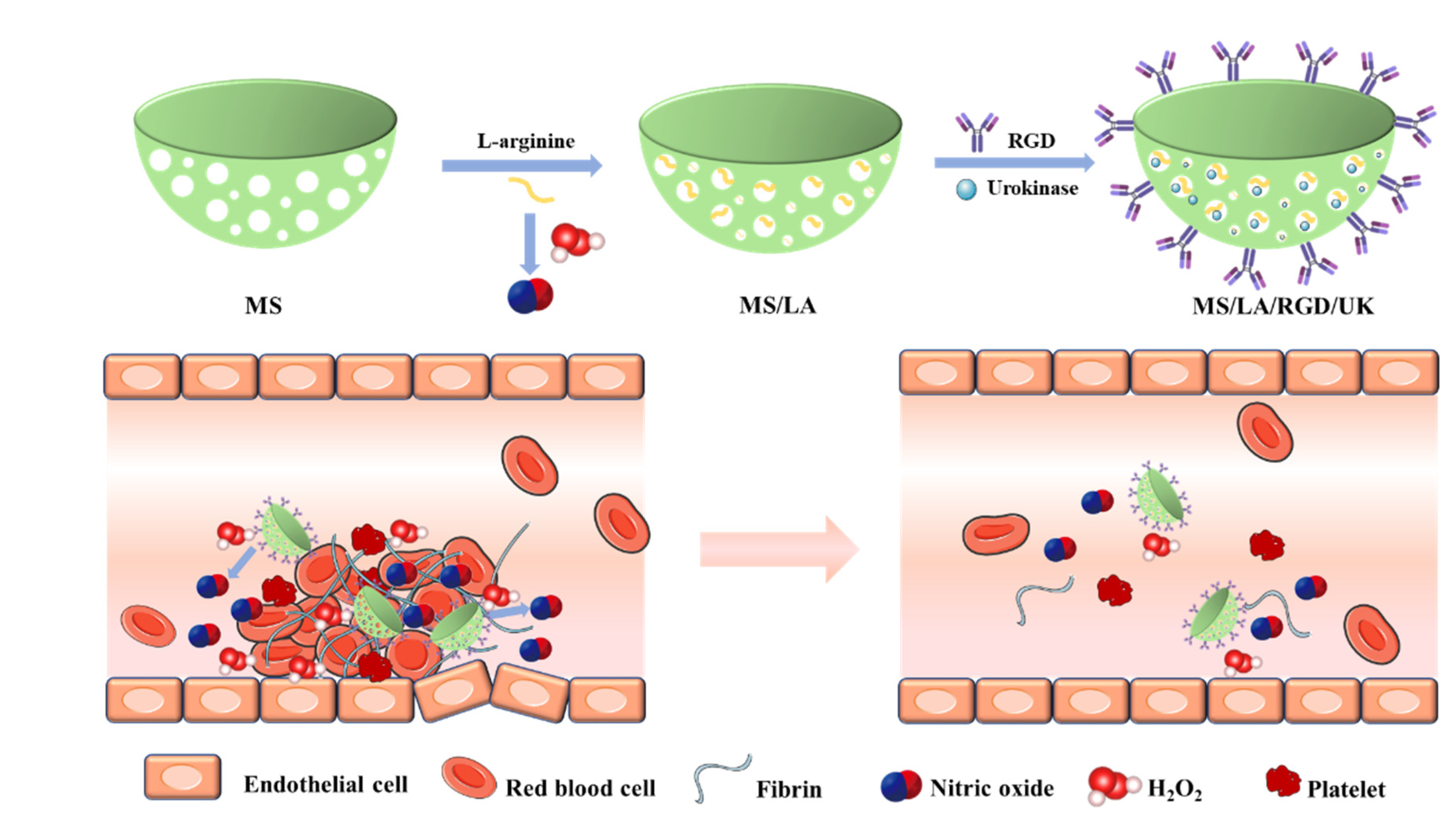 ＭＳ Novel classification of non-malignant portal vein thrombosis