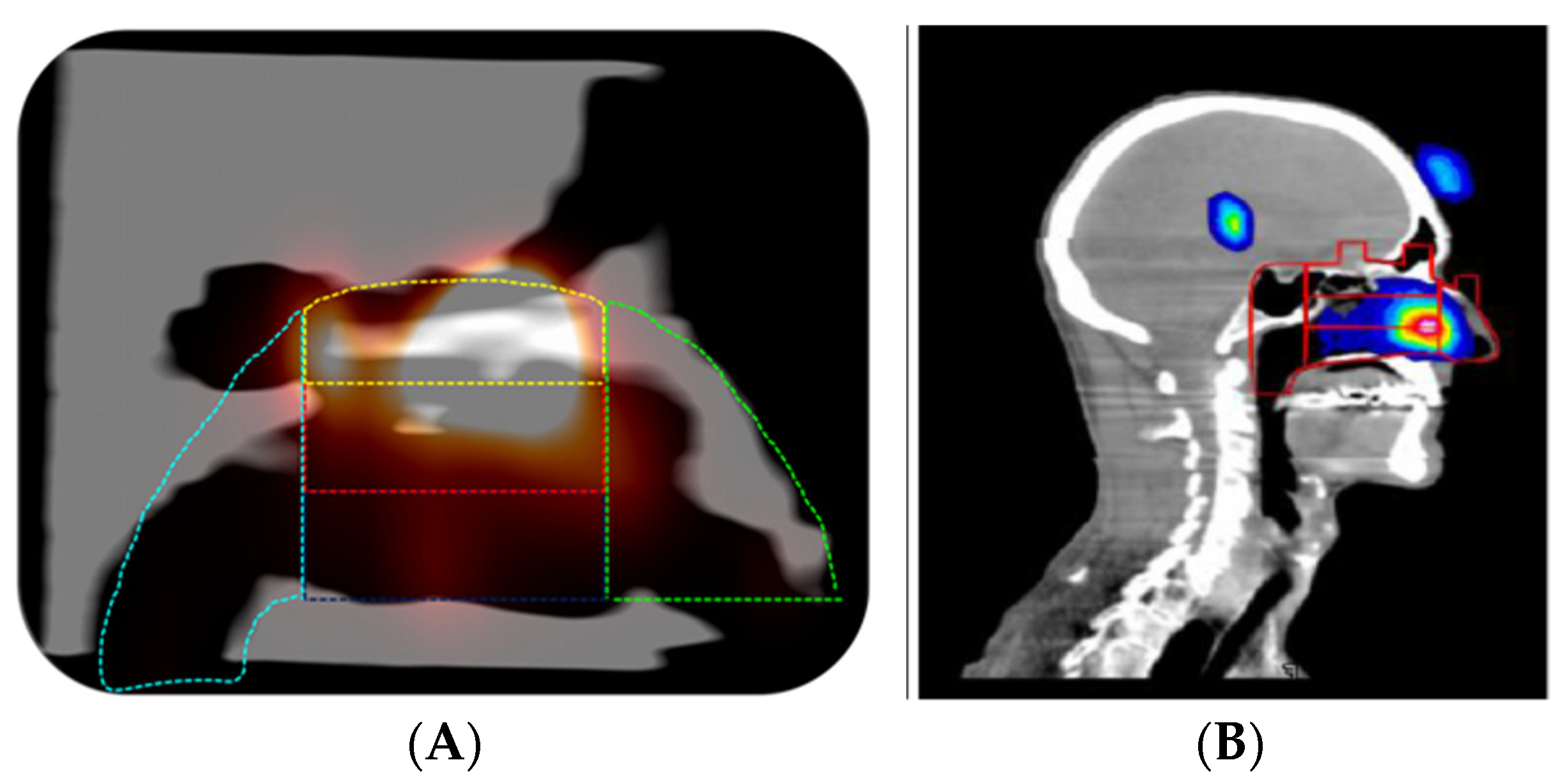 Pharmaceutics 14 01353 g009