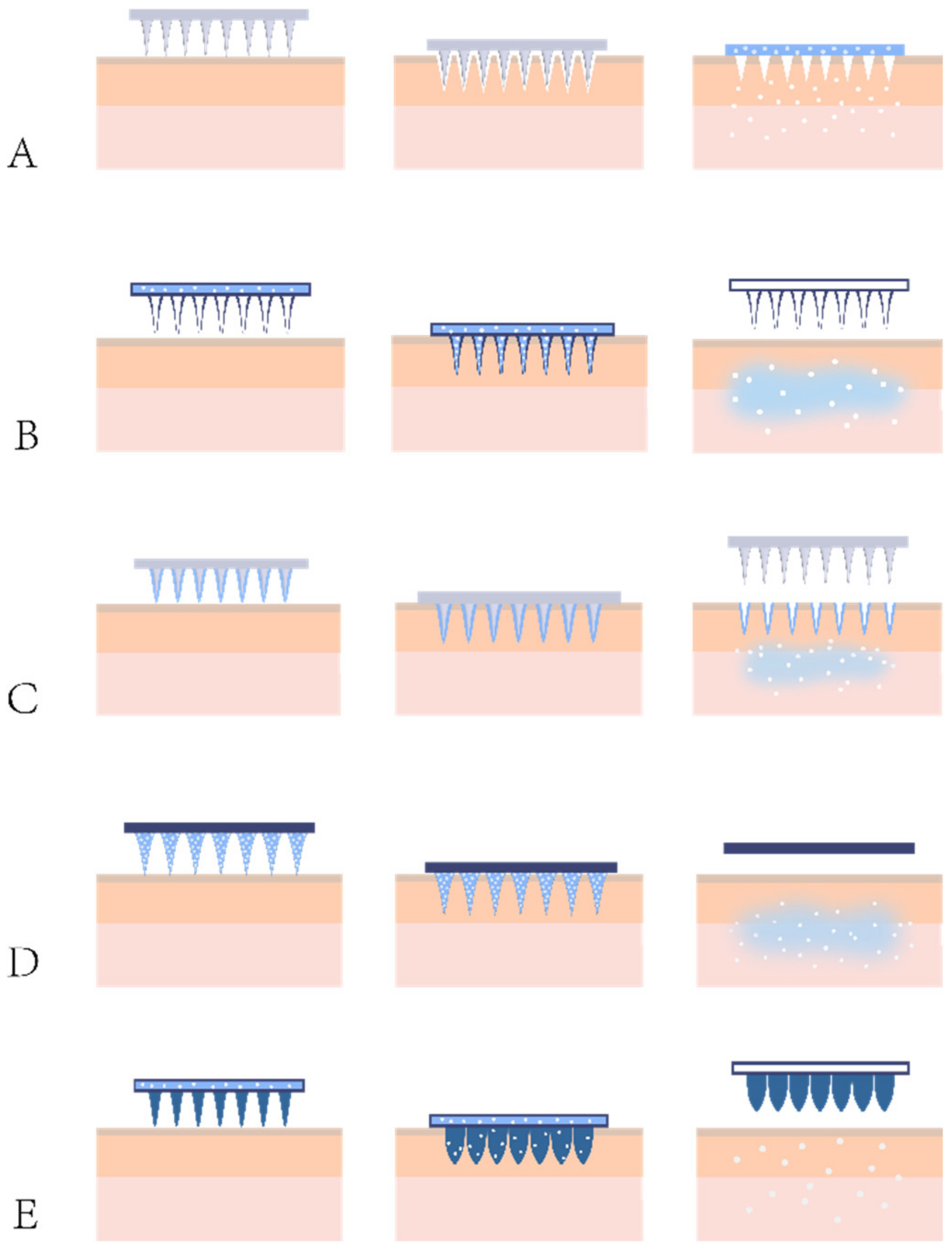 Pharmaceutics Free FullText Promising Strategies for Transdermal