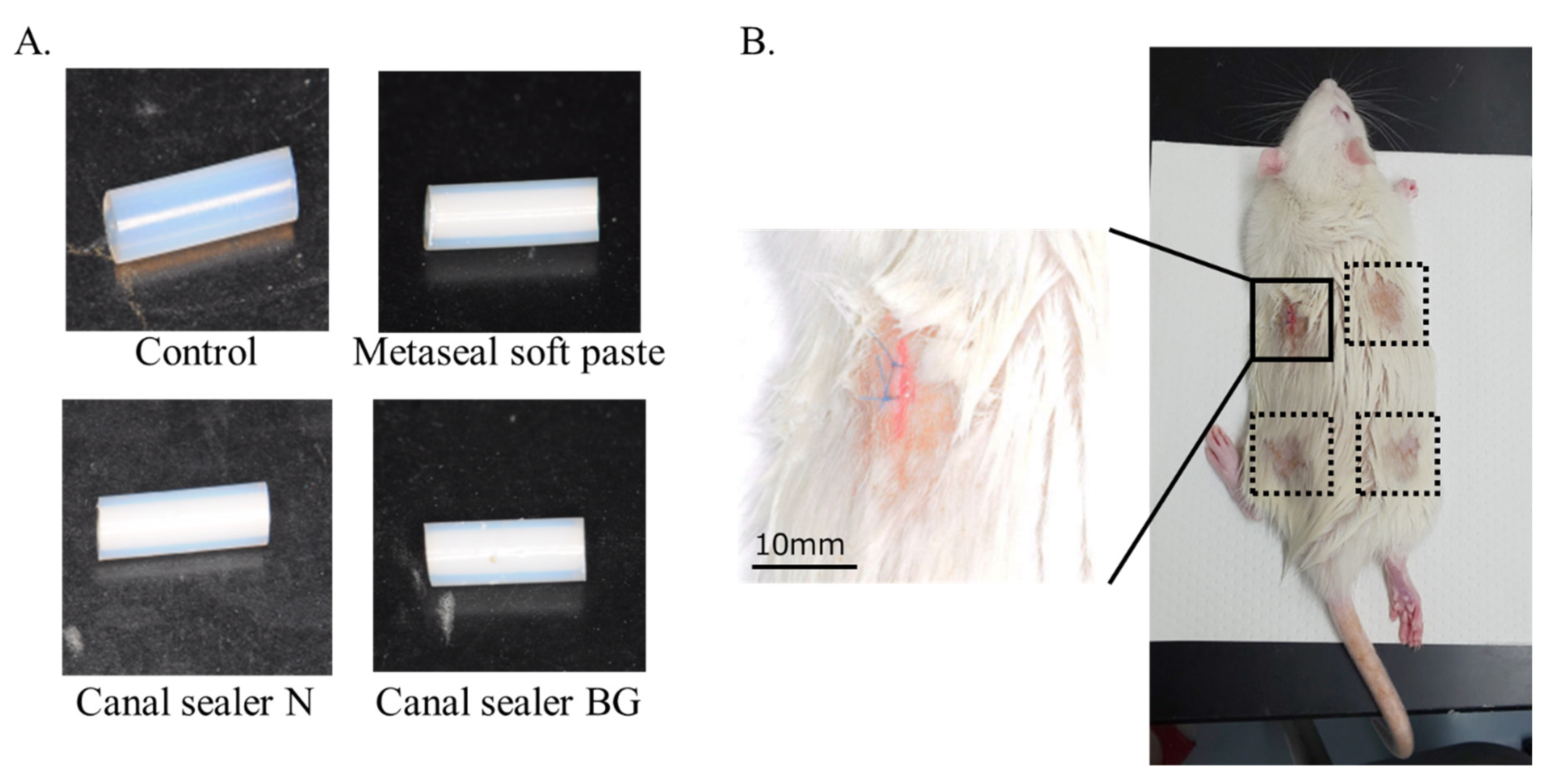 Root Canal Disinfection Using Highly Effective Aggregation-Induced