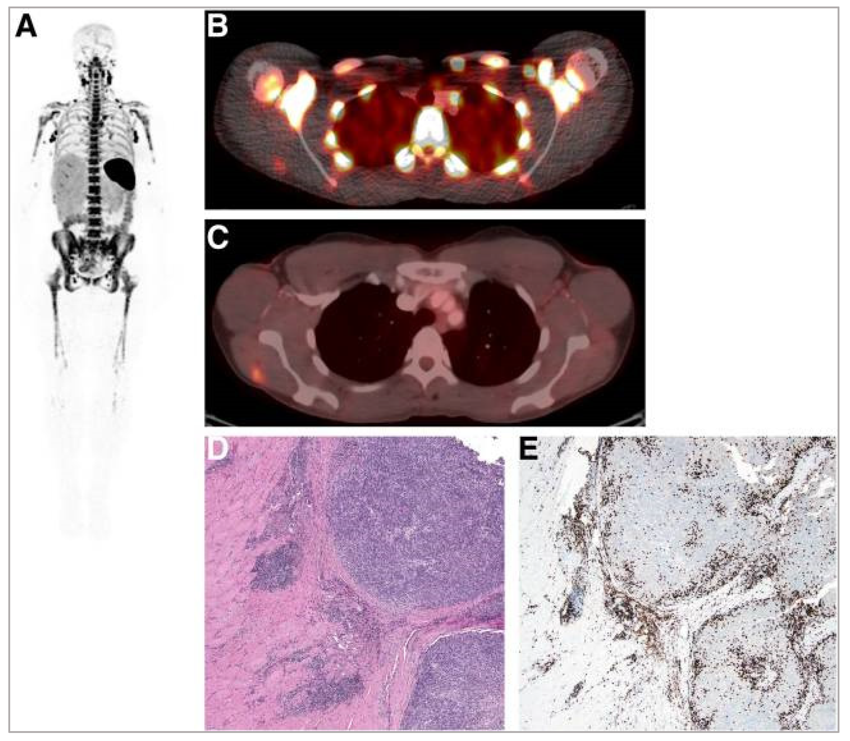 Pharmaceutics 14 02040 g006 Pharmaceutics 14 02040 g006