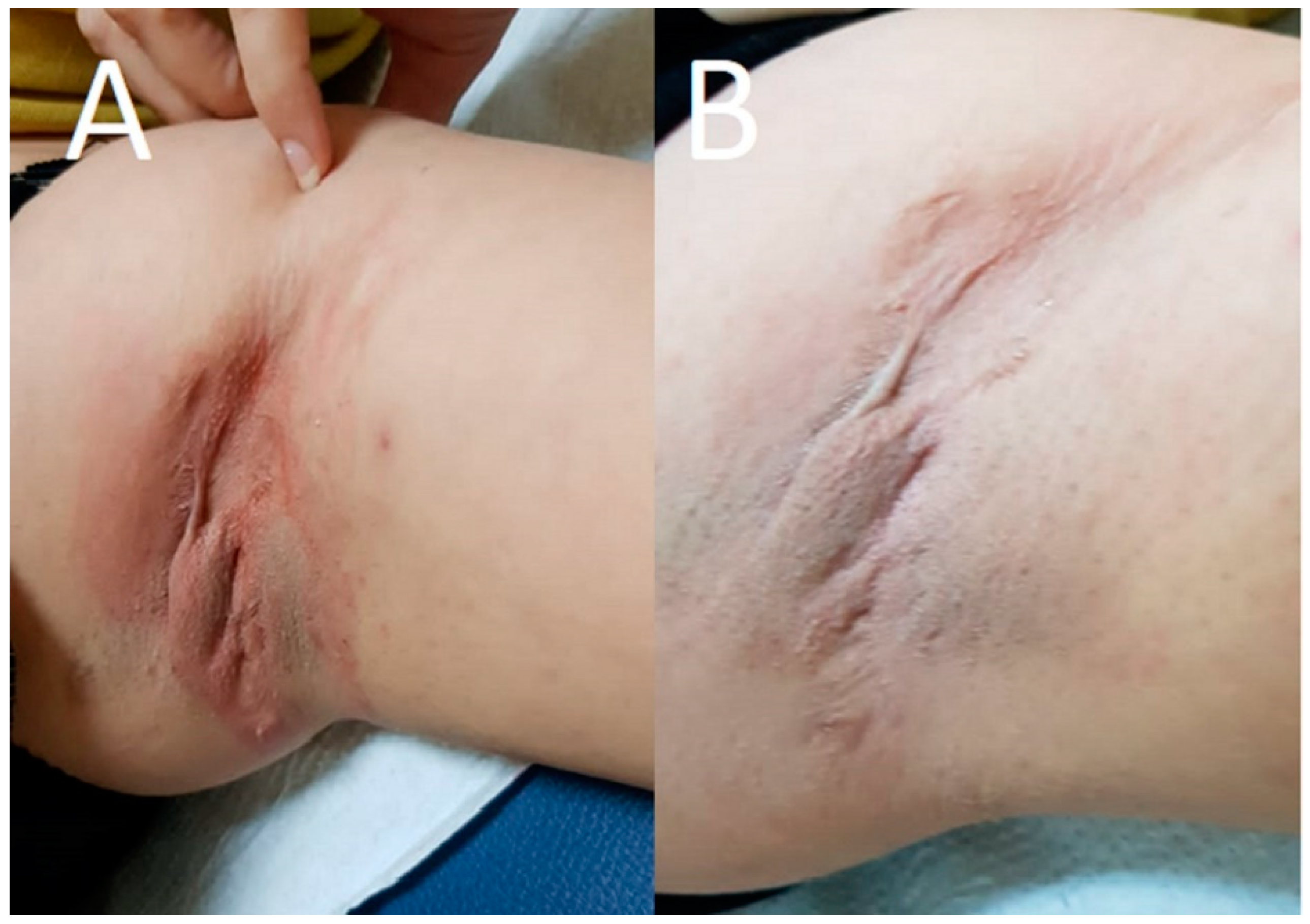 Pharmaceutics 14 02197 g004 Pharmaceutics 14 02197 g004