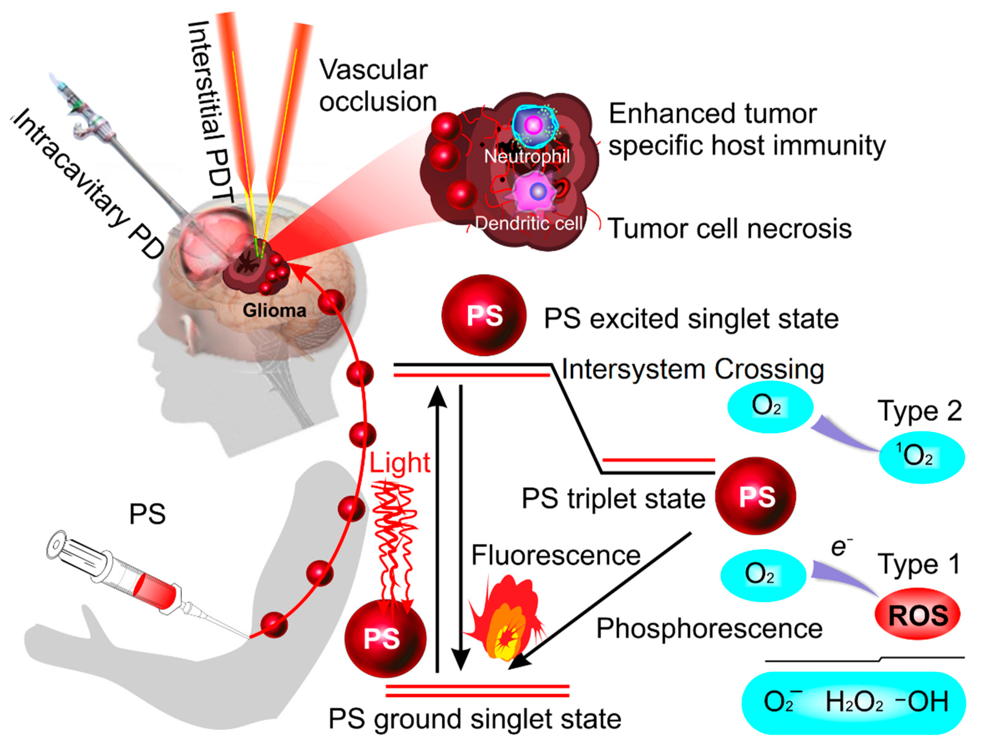 Pharmaceutics | Free Full-Text | Photodynamic Opening of the  Blood–Brain Barrier and the Meningeal Lymphatic System: The New Niche  in Immunotherapy for Brain Tumors
