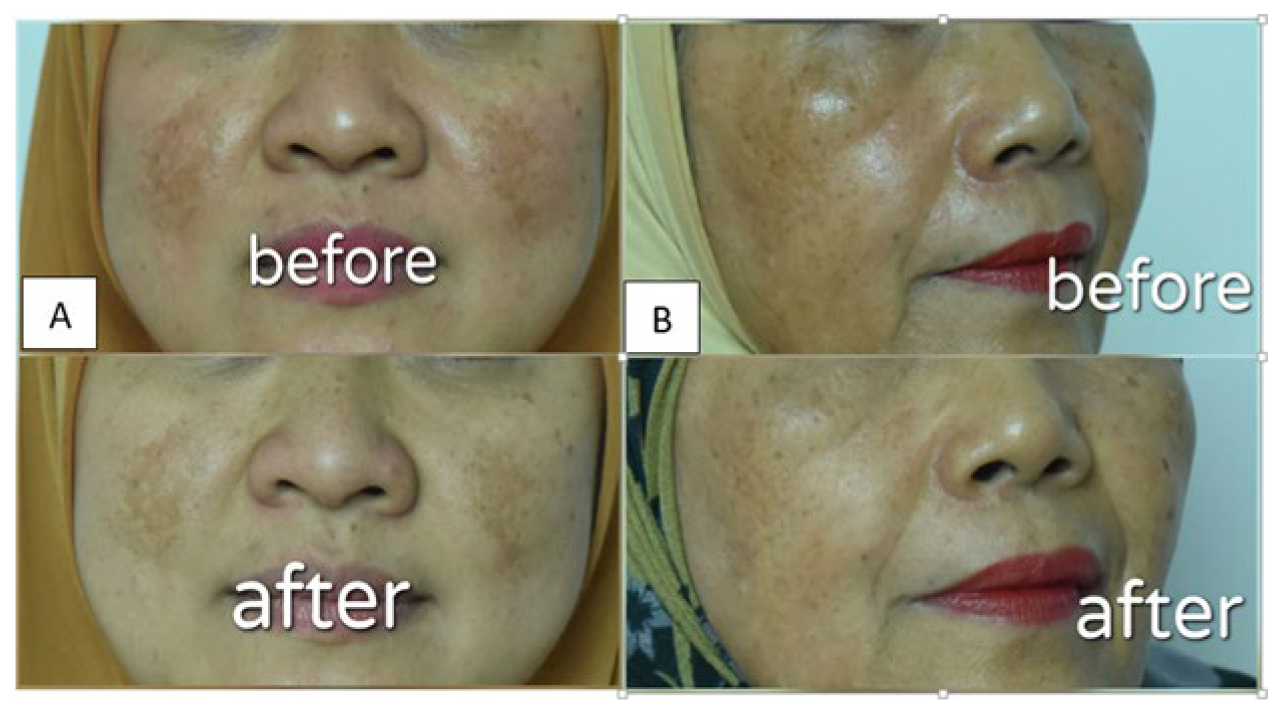 Pharmaceutics 14 02741 g006 Pharmaceutics 14 02741 g006