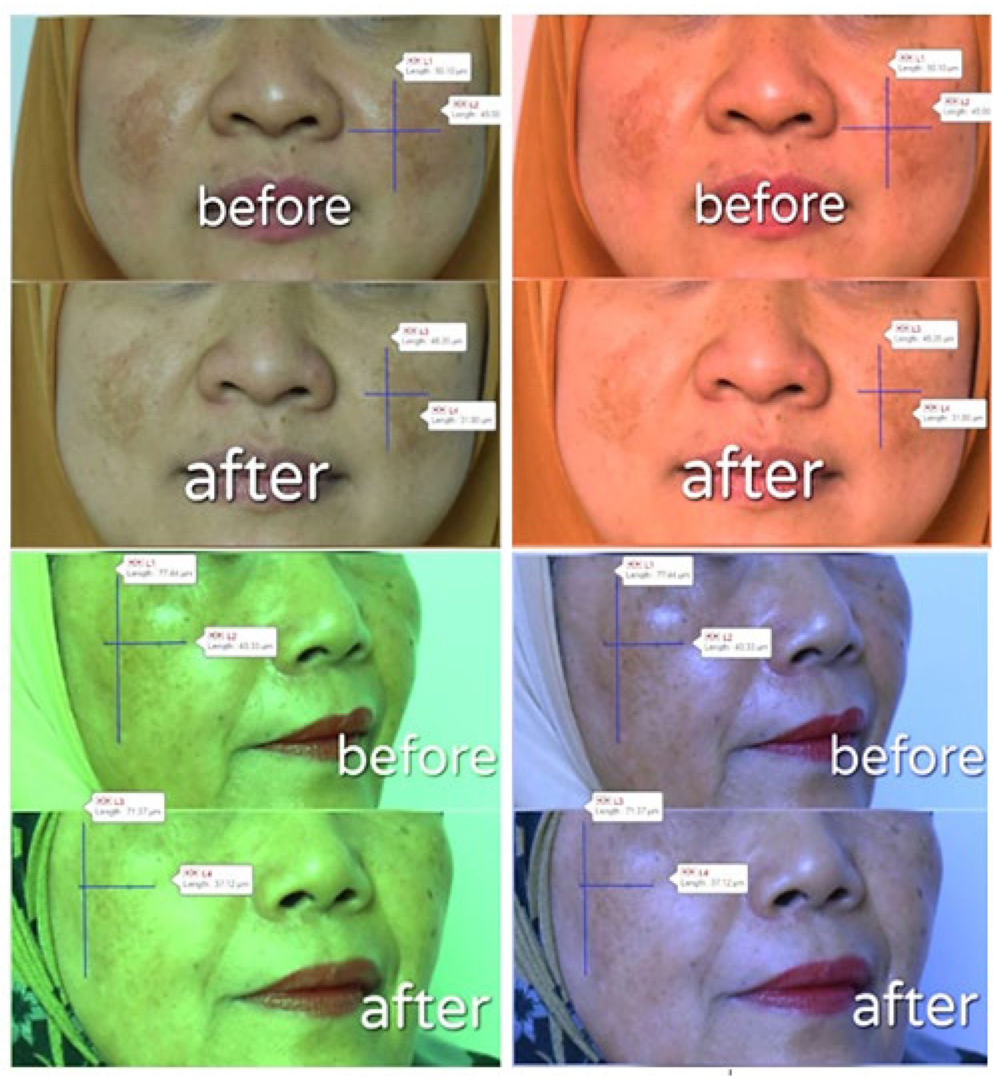 Pharmaceutics 14 02741 g008 Pharmaceutics 14 02741 g008