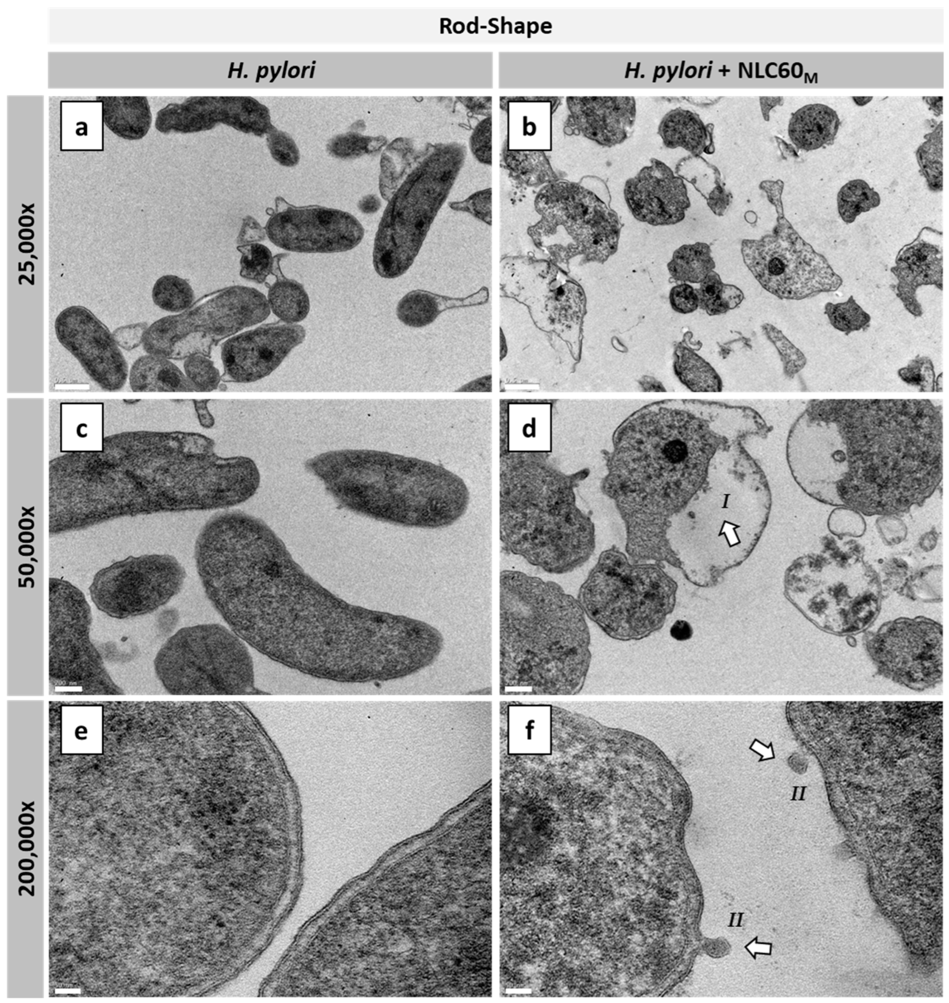 Pharmaceutics 14 02745 g007a Pharmaceutics 14 02745 g007a