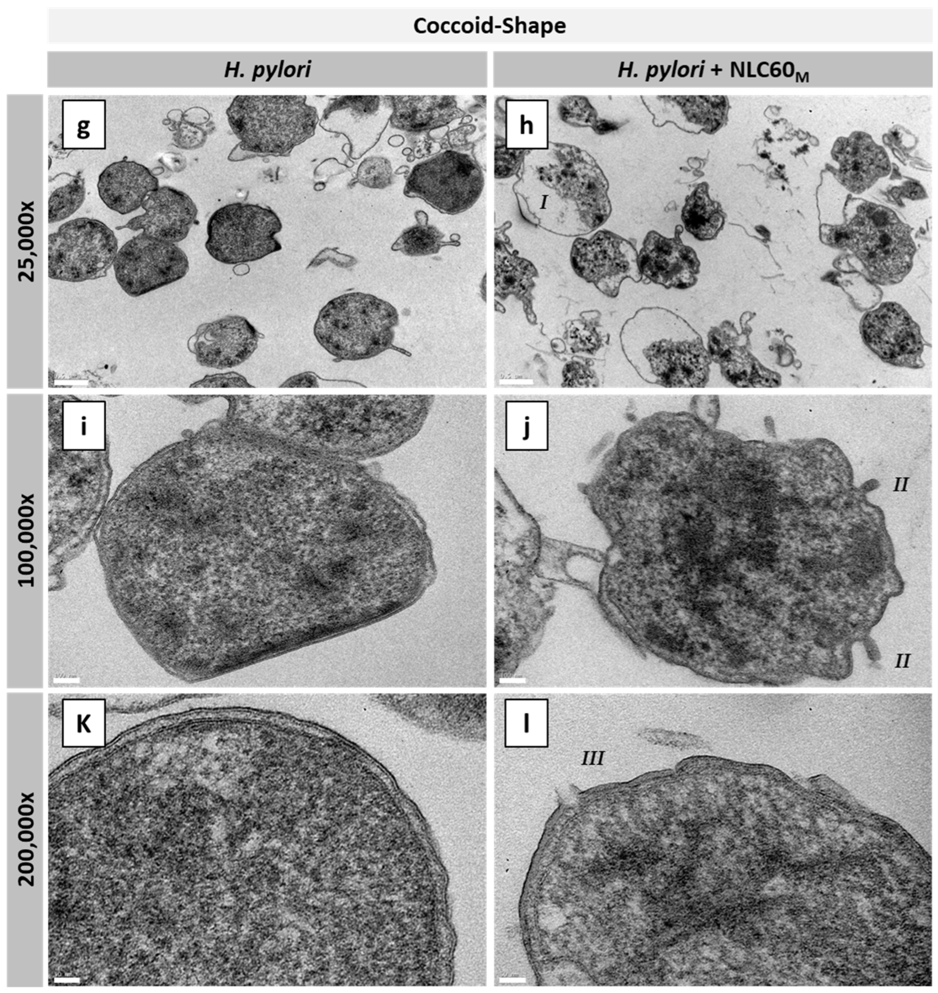 Pharmaceutics 14 02745 g007b Pharmaceutics 14 02745 g007b