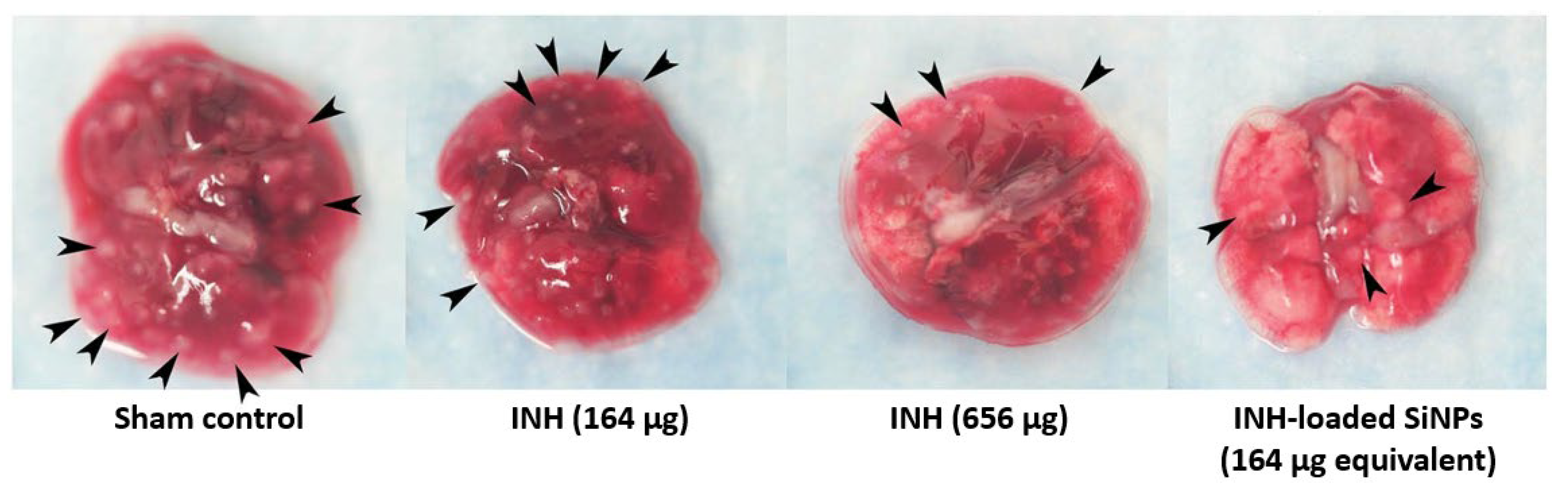 Pharmaceutics 15 00393 g010 Pharmaceutics 15 00393 g010
