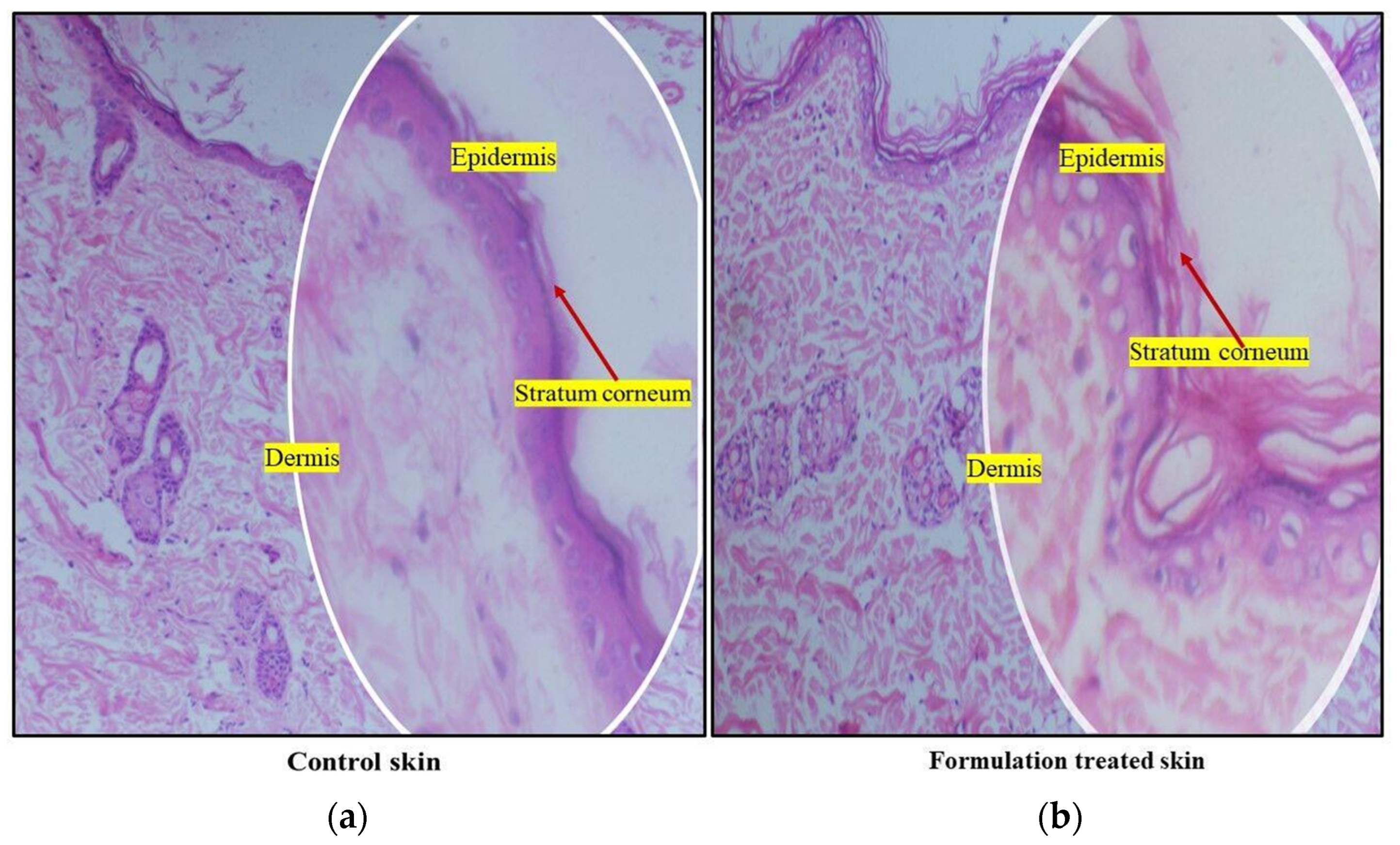 Pharmaceutics 15 00465 g012 Pharmaceutics 15 00465 g012
