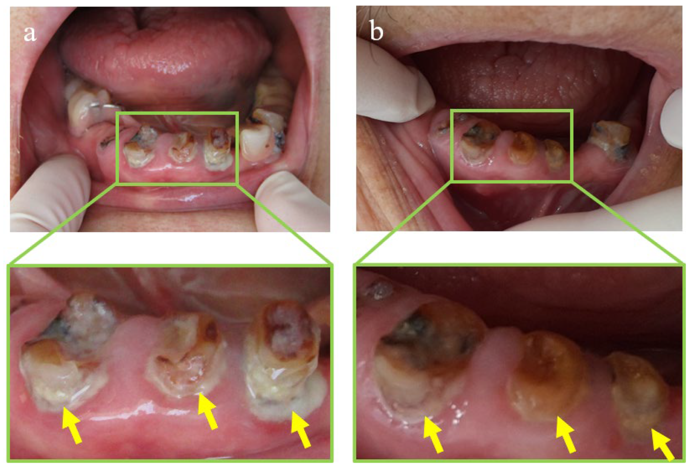 Pharmaceutics 15 00544 g007