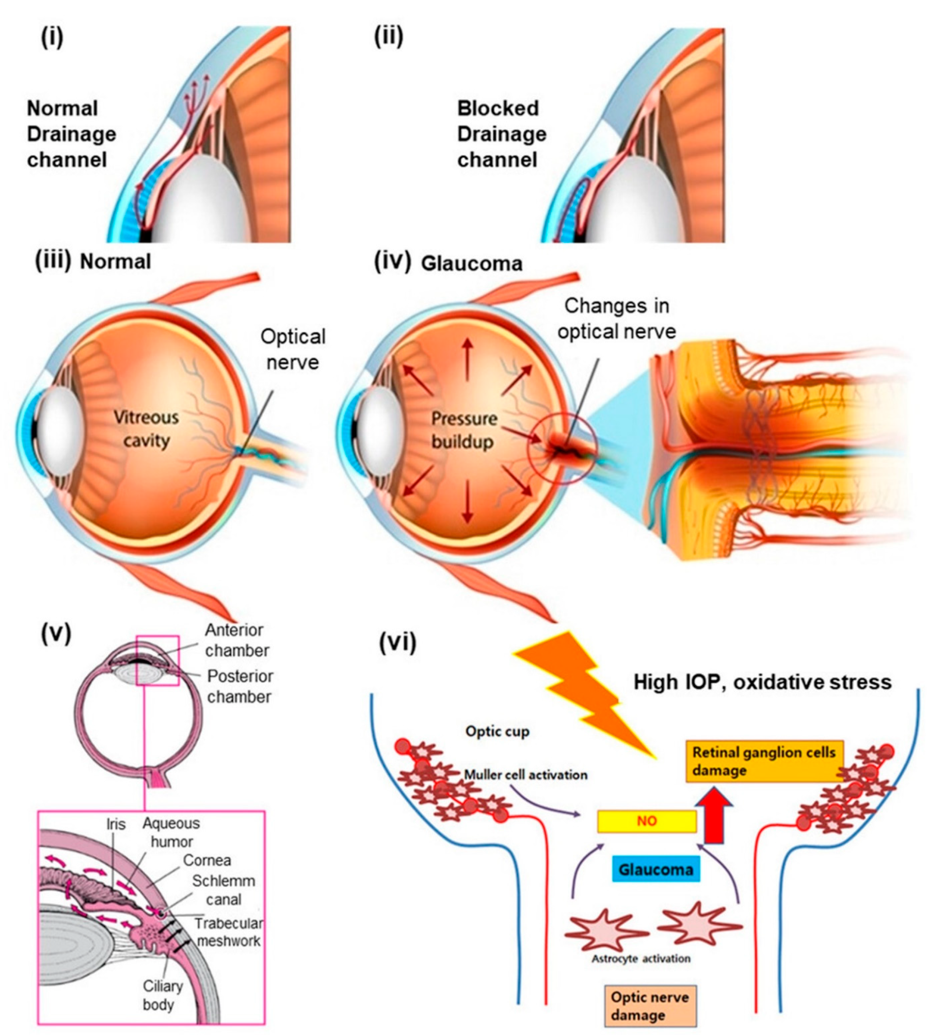 Amination-mediated nano eye-drops with enhanced corneal permeability and  effective burst release for acute glaucoma treatment - ScienceDirect