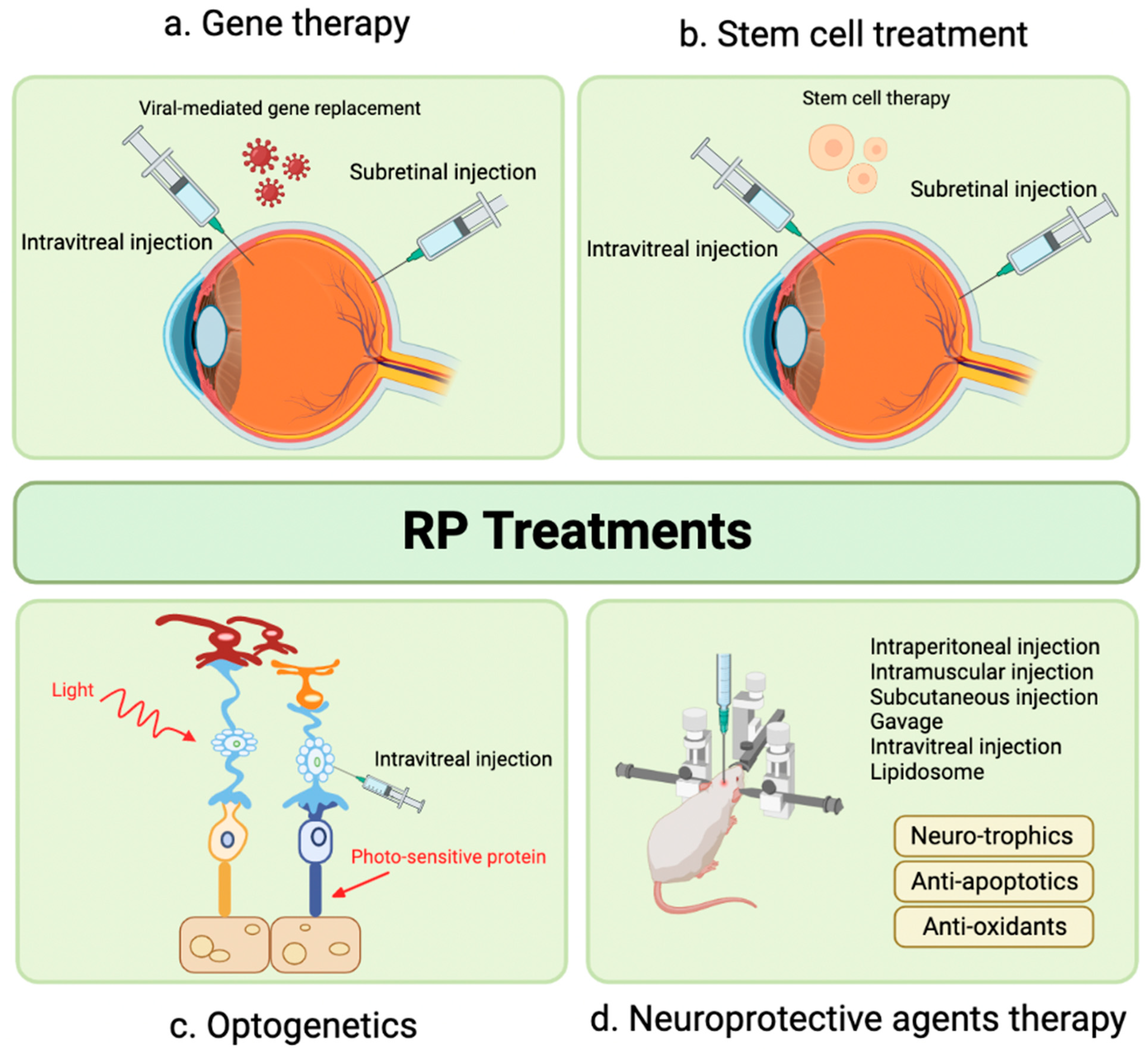 Retina - Gene Vision