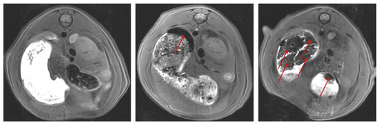 Evaluation of Pharmacobezoar Formation from Suspensions of Spray-Dried ...