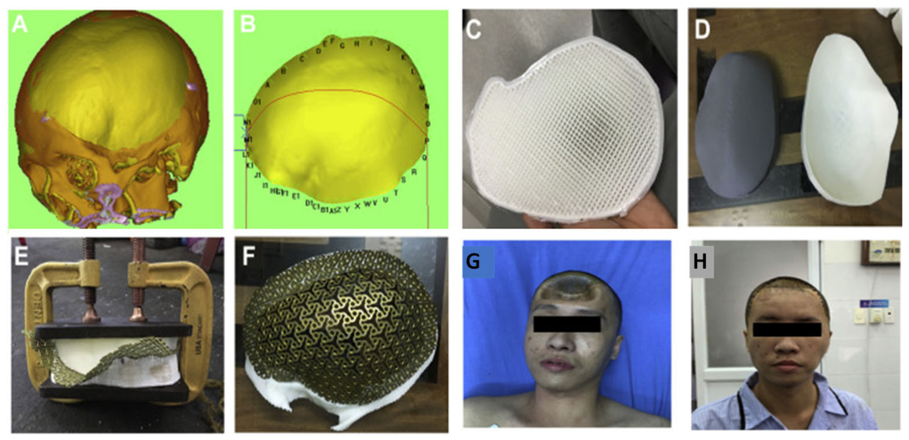 Pharmaceutics 15 00892 g003 Pharmaceutics 15 00892 g003