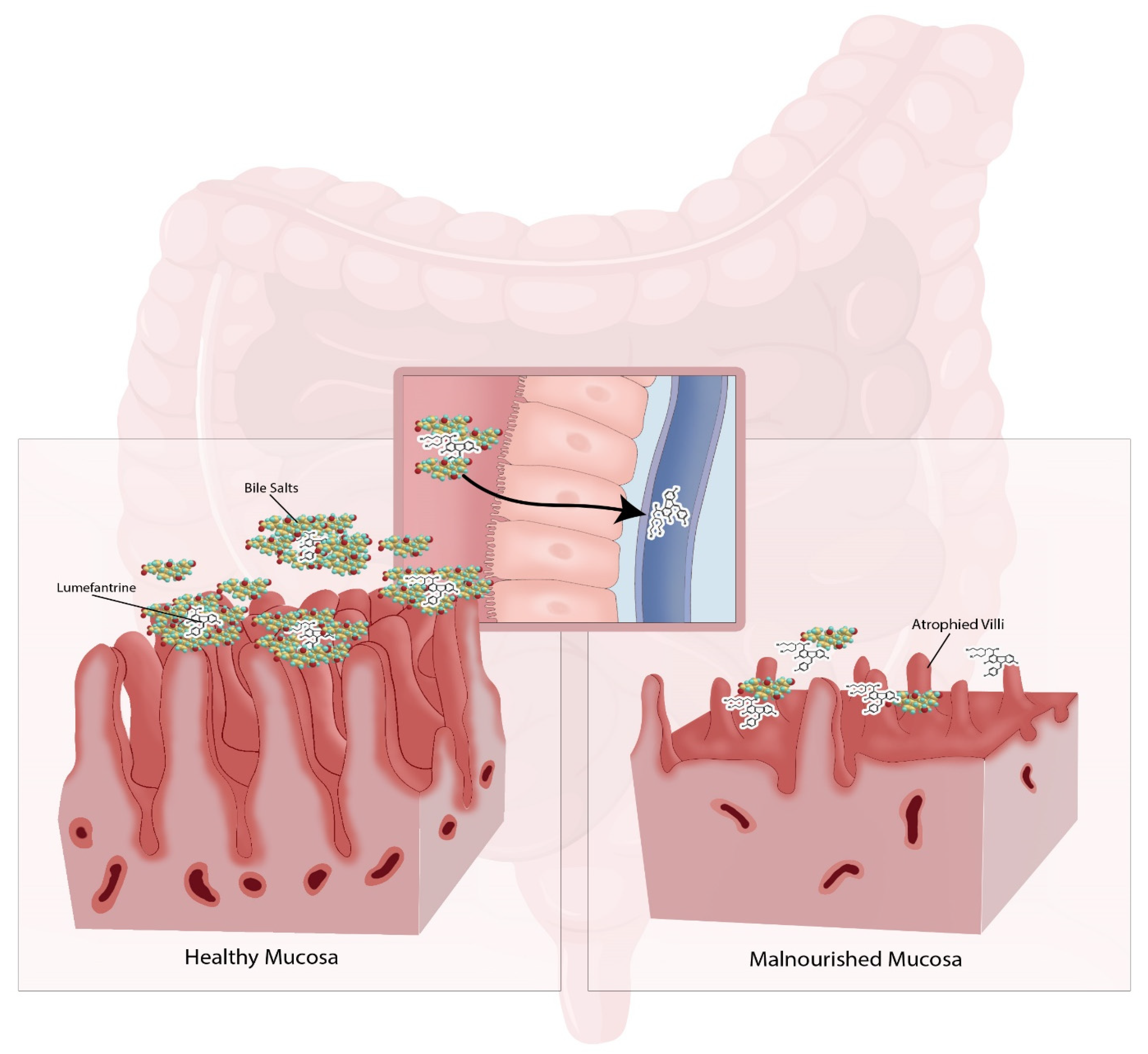 Pharmaceutics 15 01076 g001 Pharmaceutics 15 01076 g001