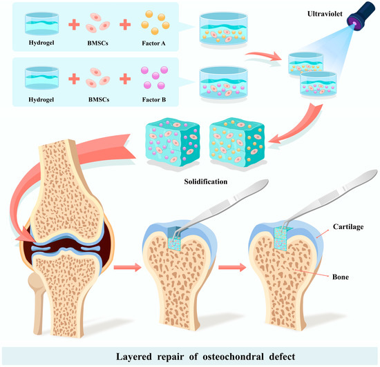 Pharmaceutics free full text hydrogel drug delivery systems for