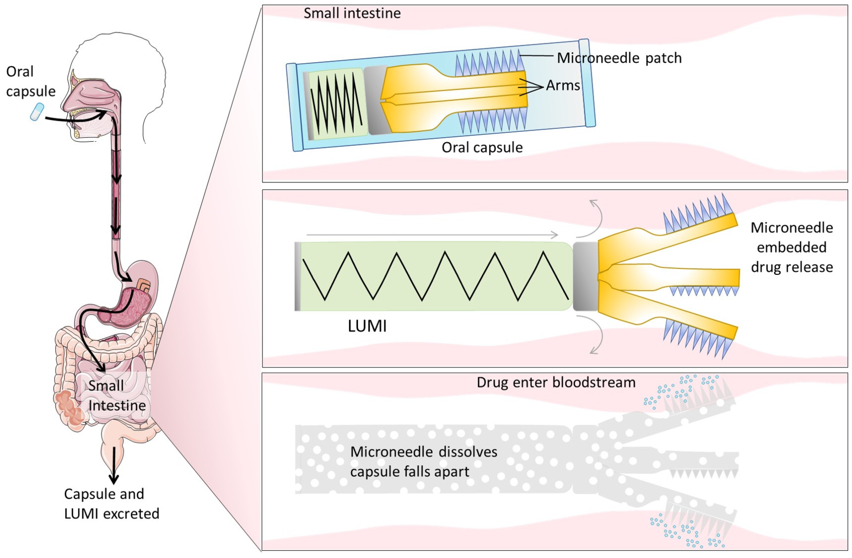 Pharmaceutics 15 01415 g013