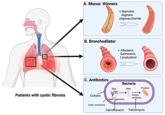 Does Lung Transplant Cure Cystic Fibrosis Pharmaceutics | Free Full-Text | Dry Powder Inhalation for Lung