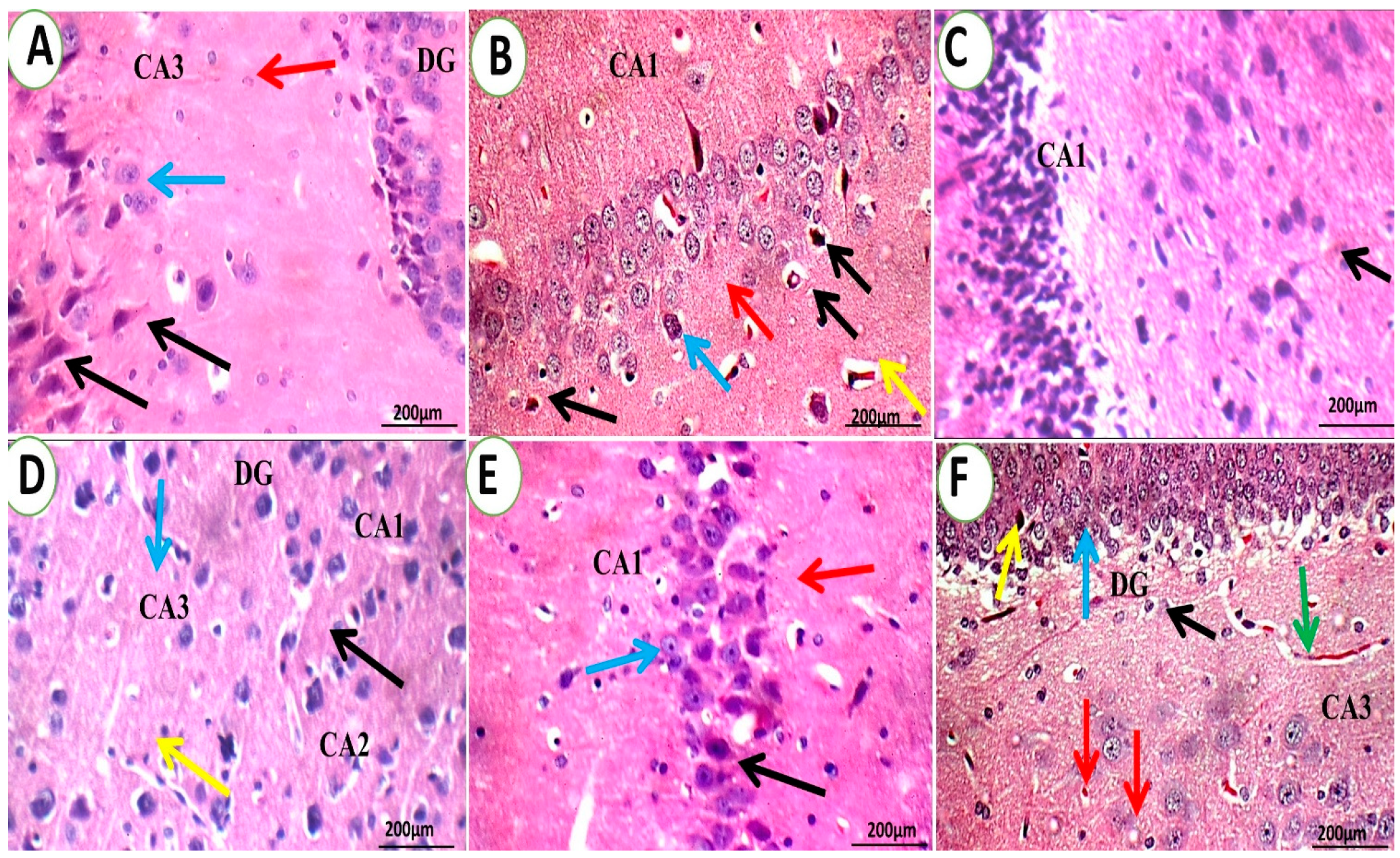 Pharmaceutics 15 02095 g011