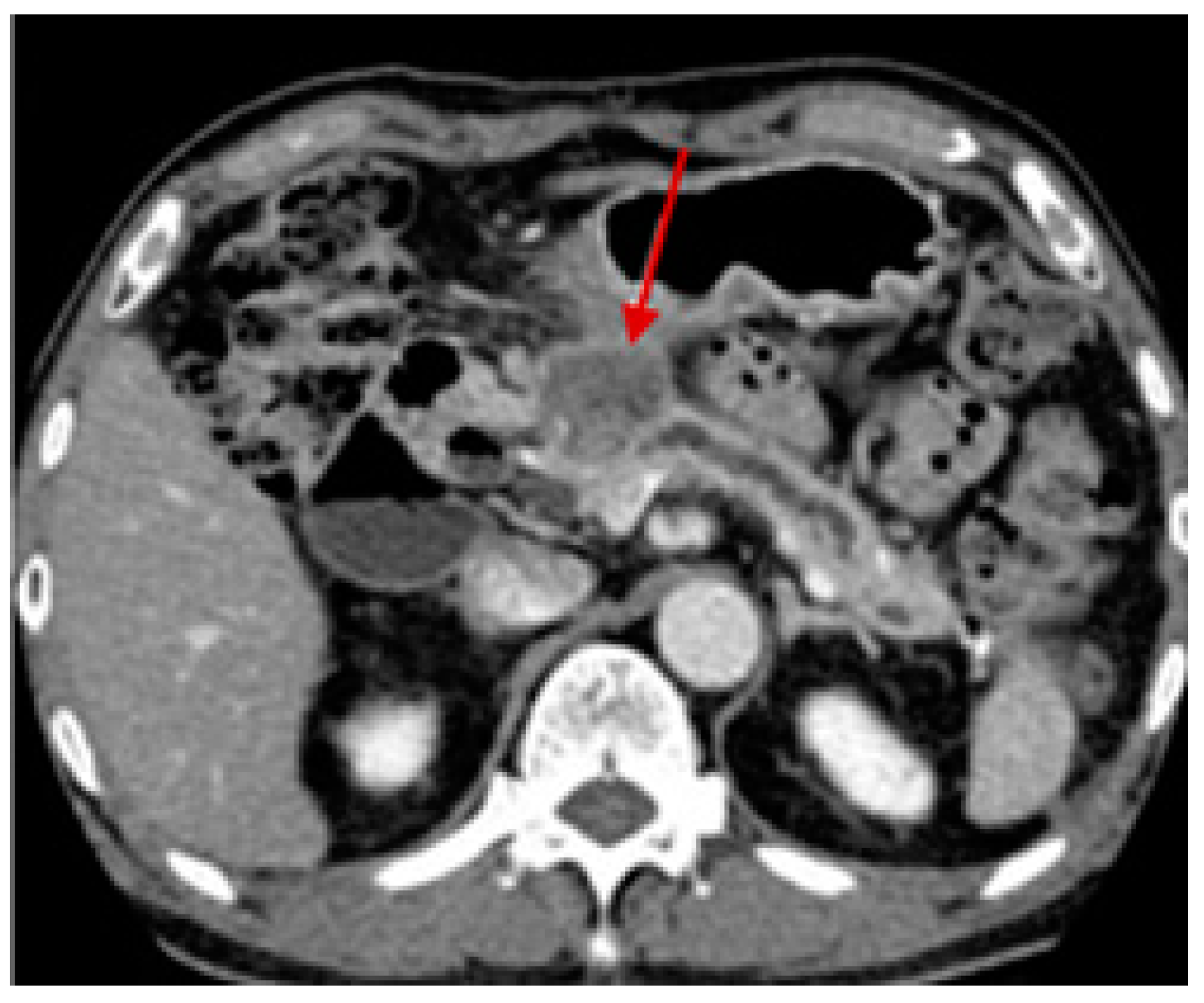 Pharmaceutics 15 02363 g003 Pharmaceutics 15 02363 g003