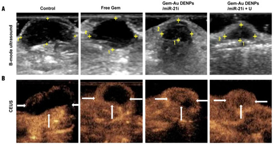 Advances in Pancreatic Cancer Treatment by Nano-Based Drug Delivery Systems