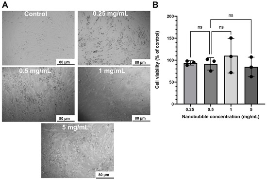 SIGMA - たむら Ultrasound-Responsive Nanobubbles for Combined siRNA-Cerium