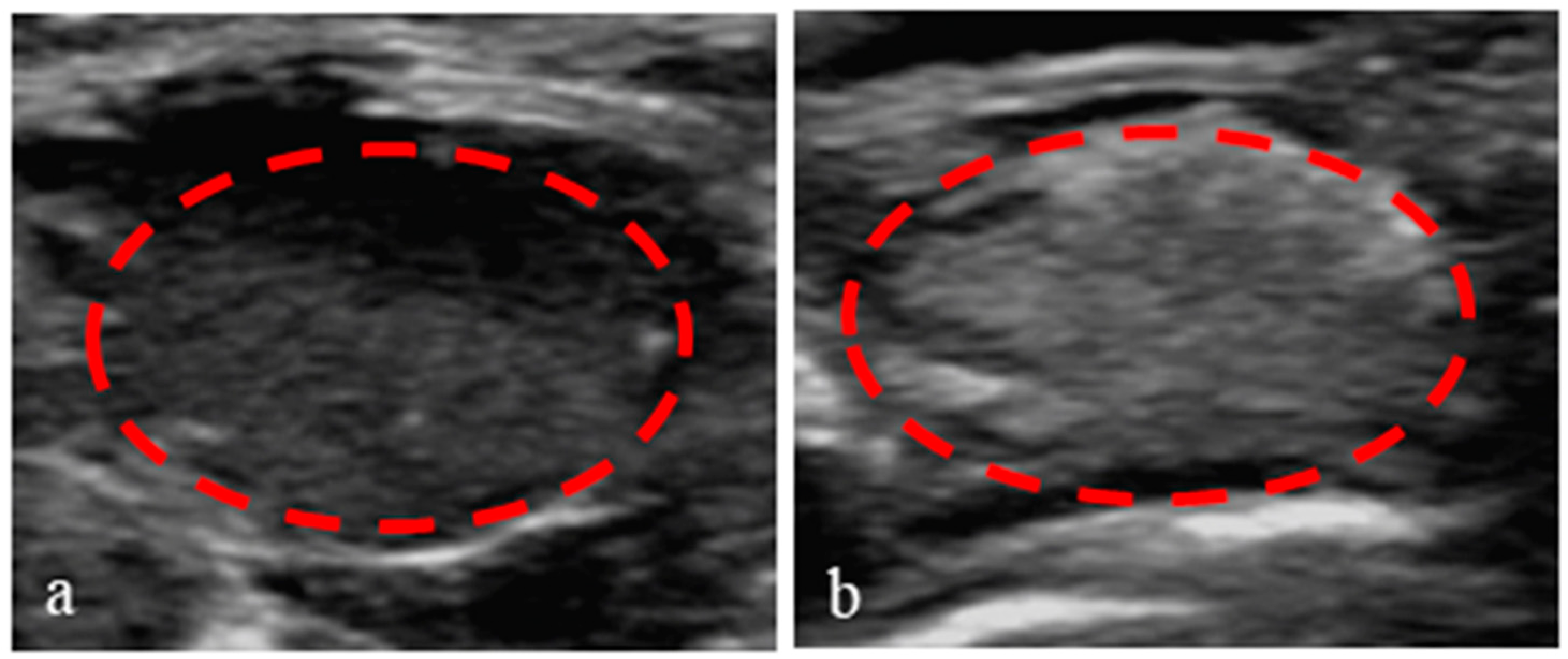 Pharmaceutics 15 02693 g015