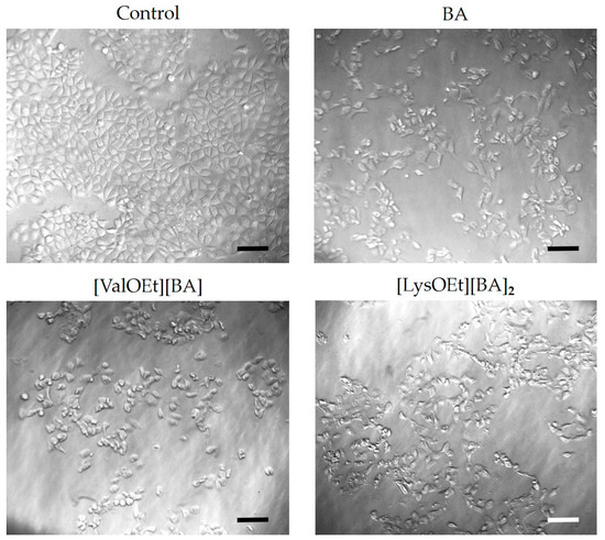 Tuning of the Anti-Breast Cancer Activity of Betulinic Acid