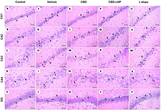 Assessing the Safety and Therapeutic Efficacy of Cannabidiol Lipid