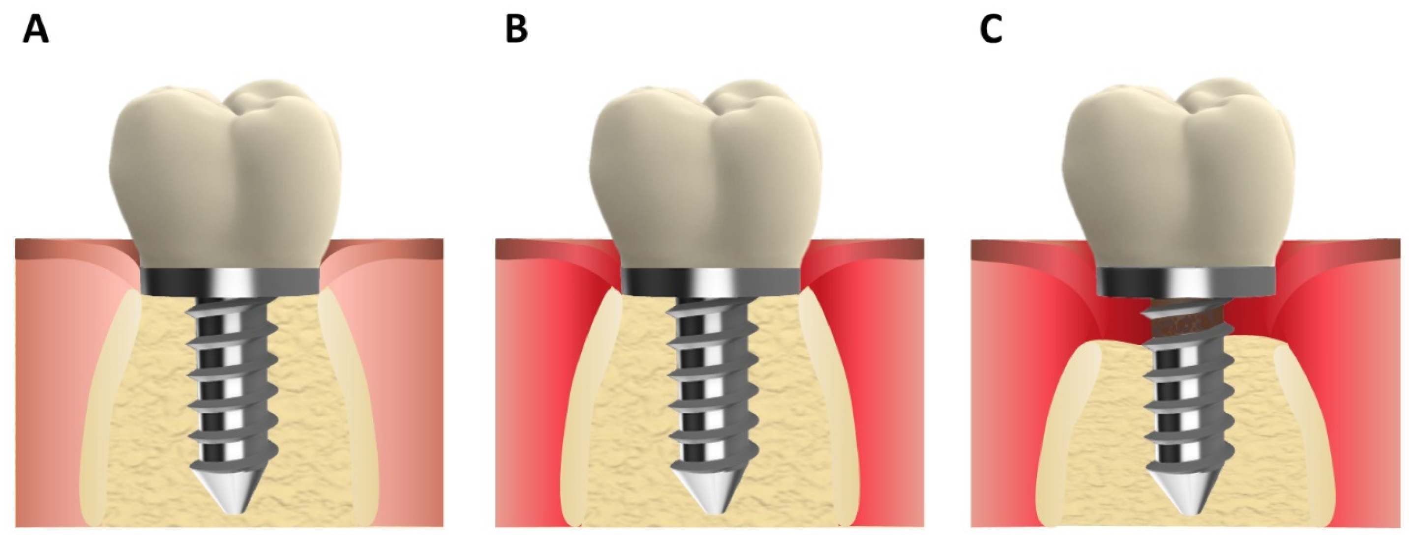 Pharmaceutics 16 00769 g001