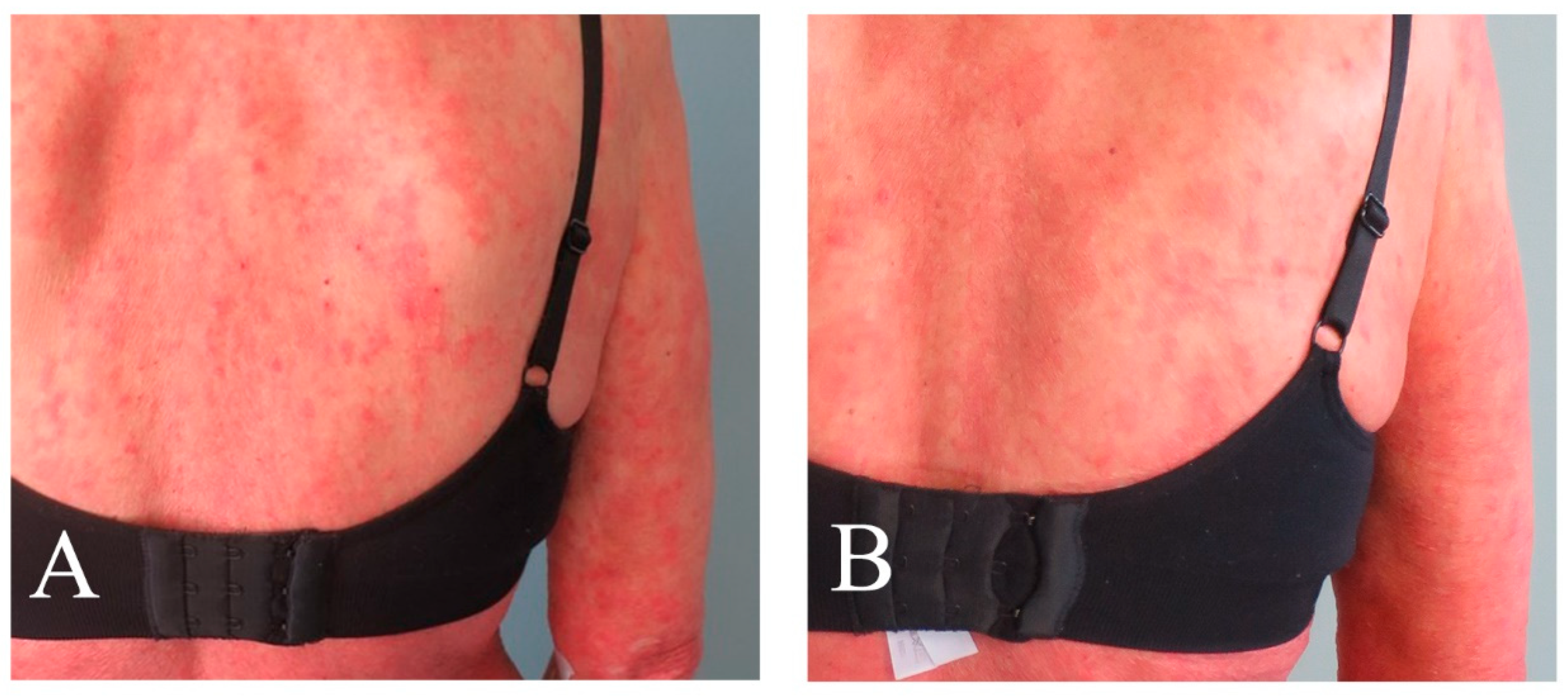 Pharmaceutics 16 00815 g002