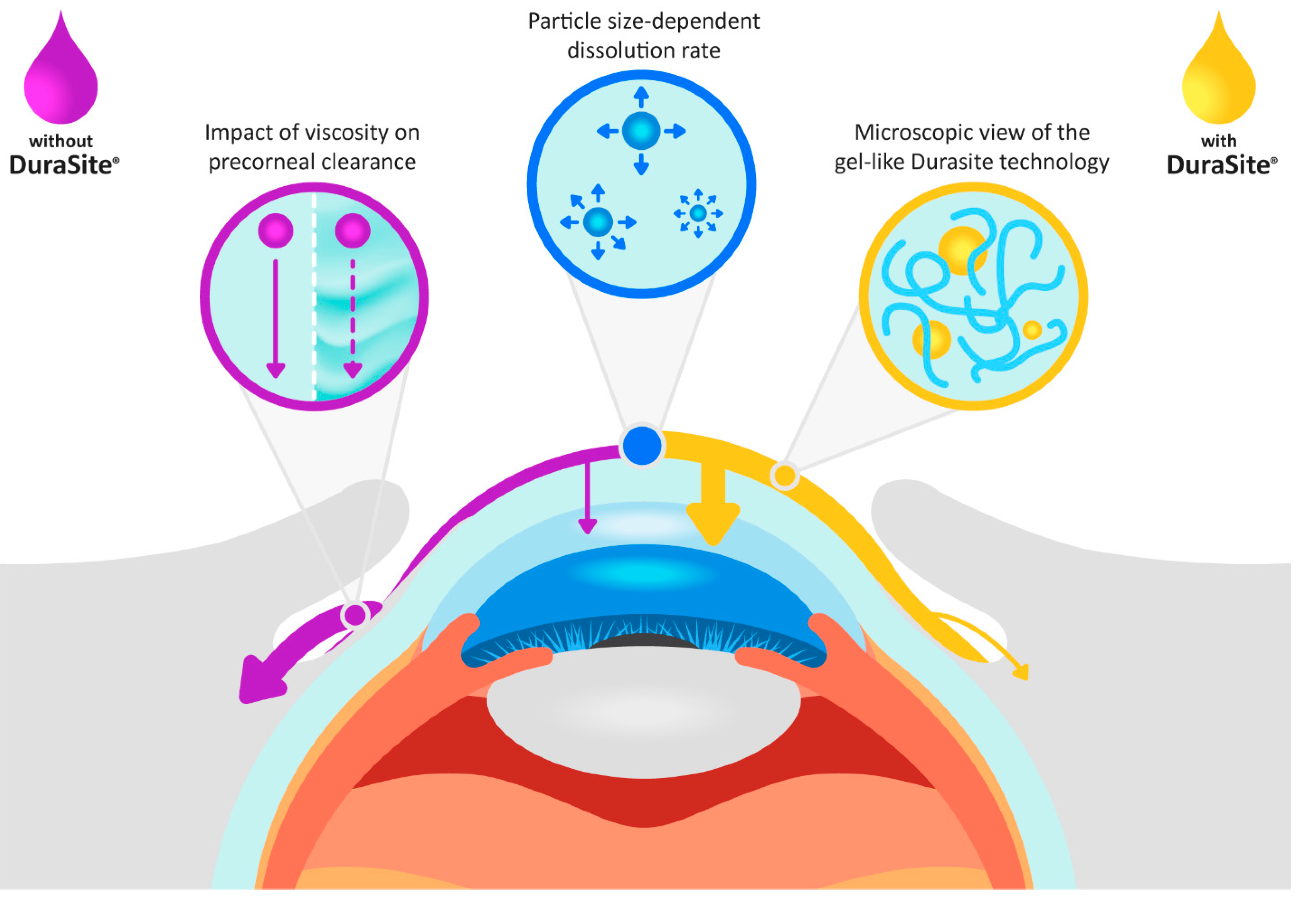 Clinical Ocular Exposure Extrapolation for a Complex