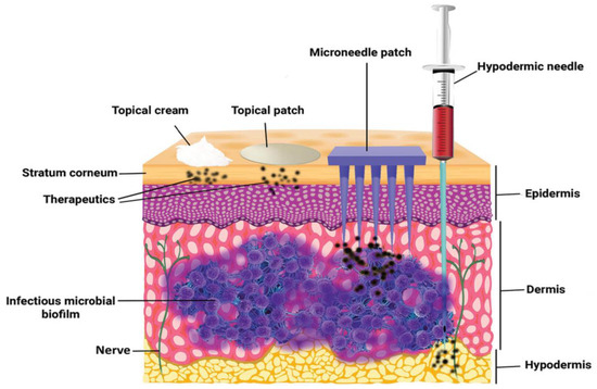 Emerging Trends in Dissolving-Microneedle Technology for