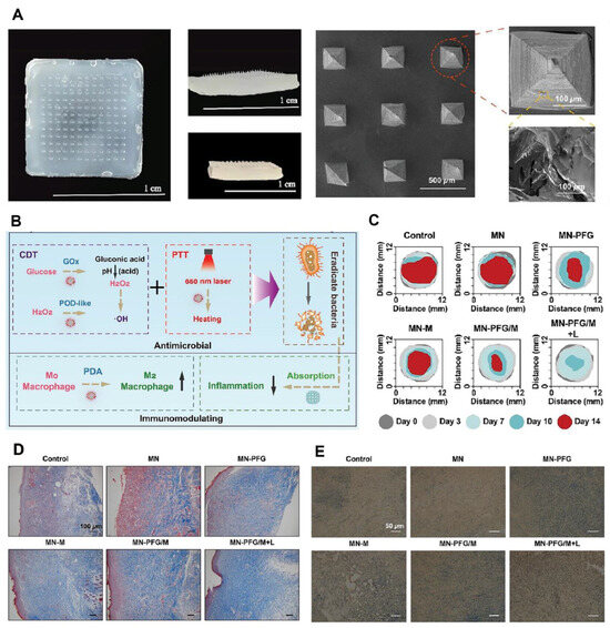 Emerging Trends in Dissolving-Microneedle Technology for