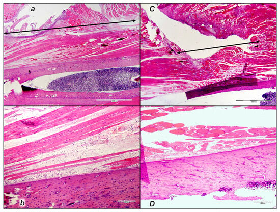 how many mg of bpc 157 to inject daily Diagnostic and Therapeutic Injection of the Ankle and Foot