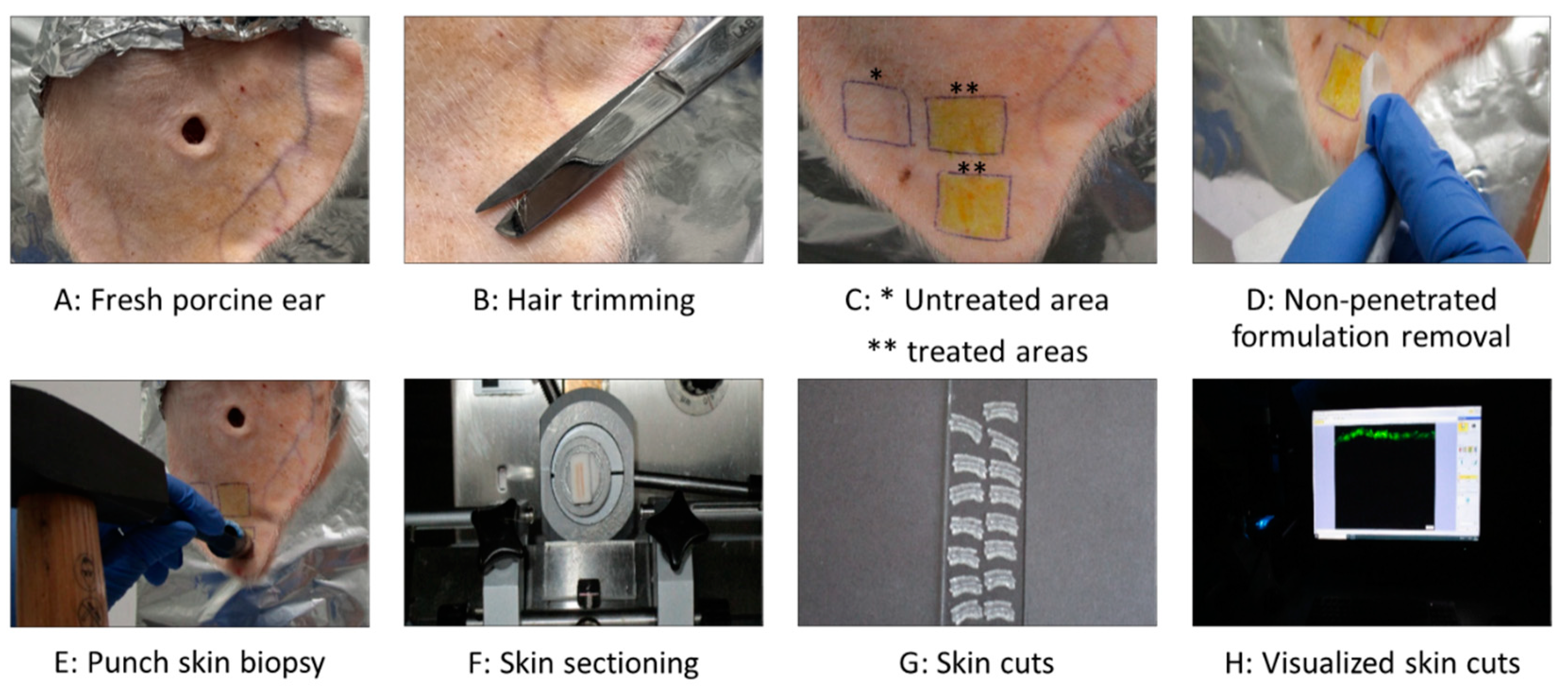 Pharmaceutics 17 00301 g001