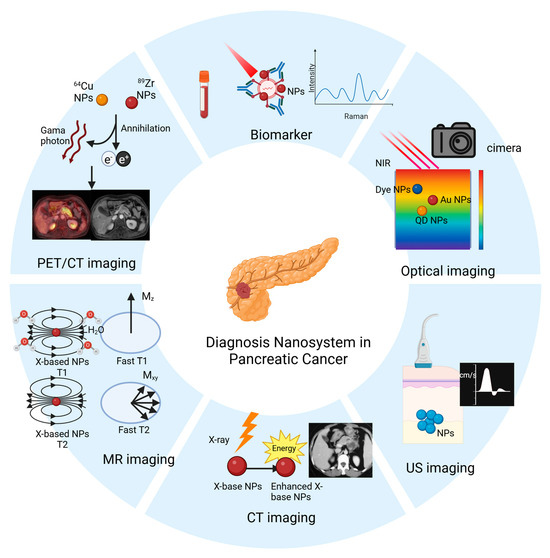 Nanomedicine in the Diagnosis and Treatment of Pancreatic Cancer