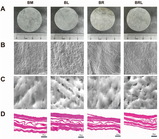 Novel Resolvin D1-Loaded Biologics as an Advanced Approach