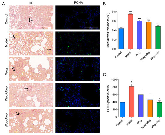 テスト Mechanistic Insight into the Enhanced Anti-Pulmonary