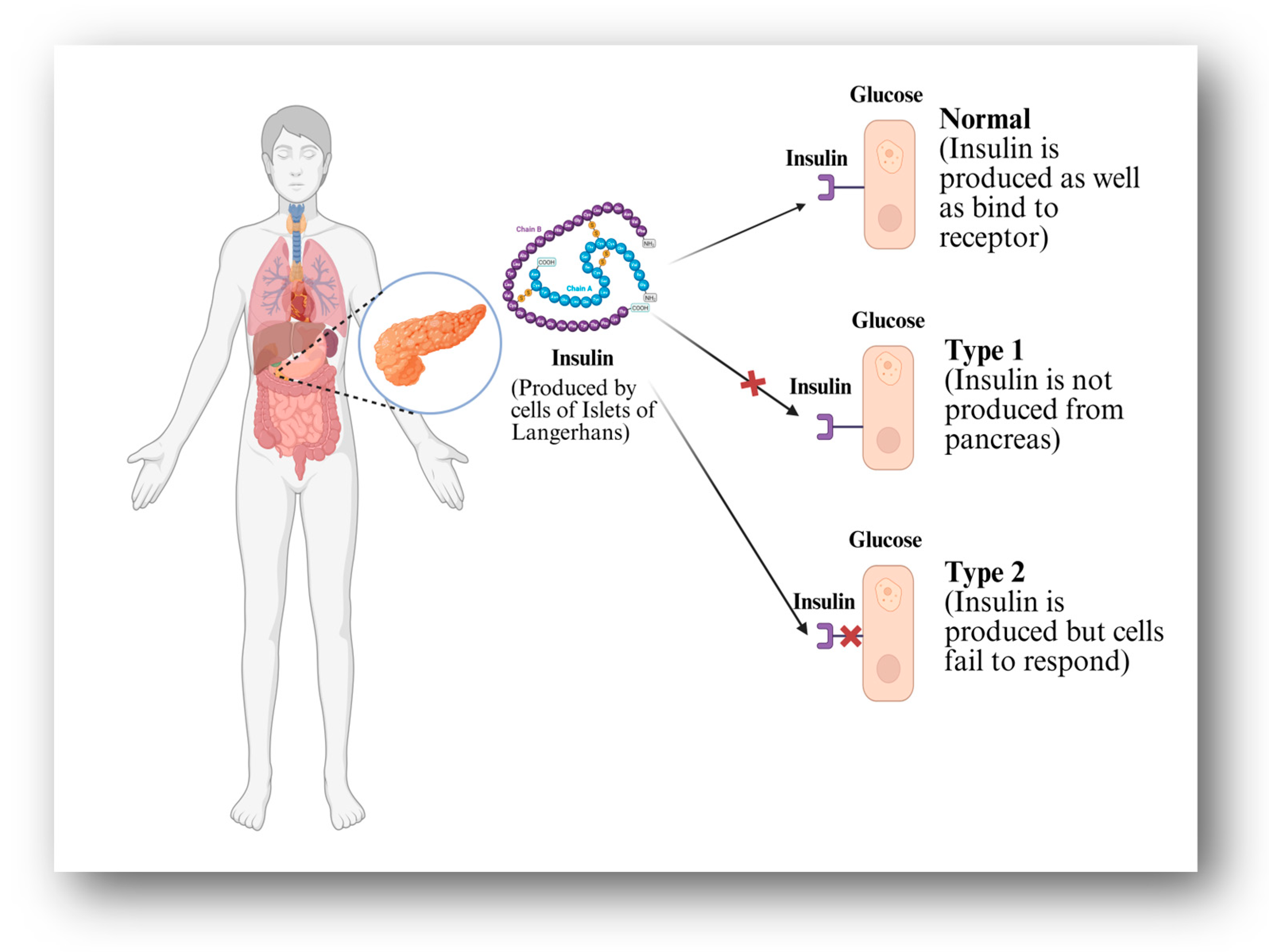 Pharmaceutics 17 00777 g001