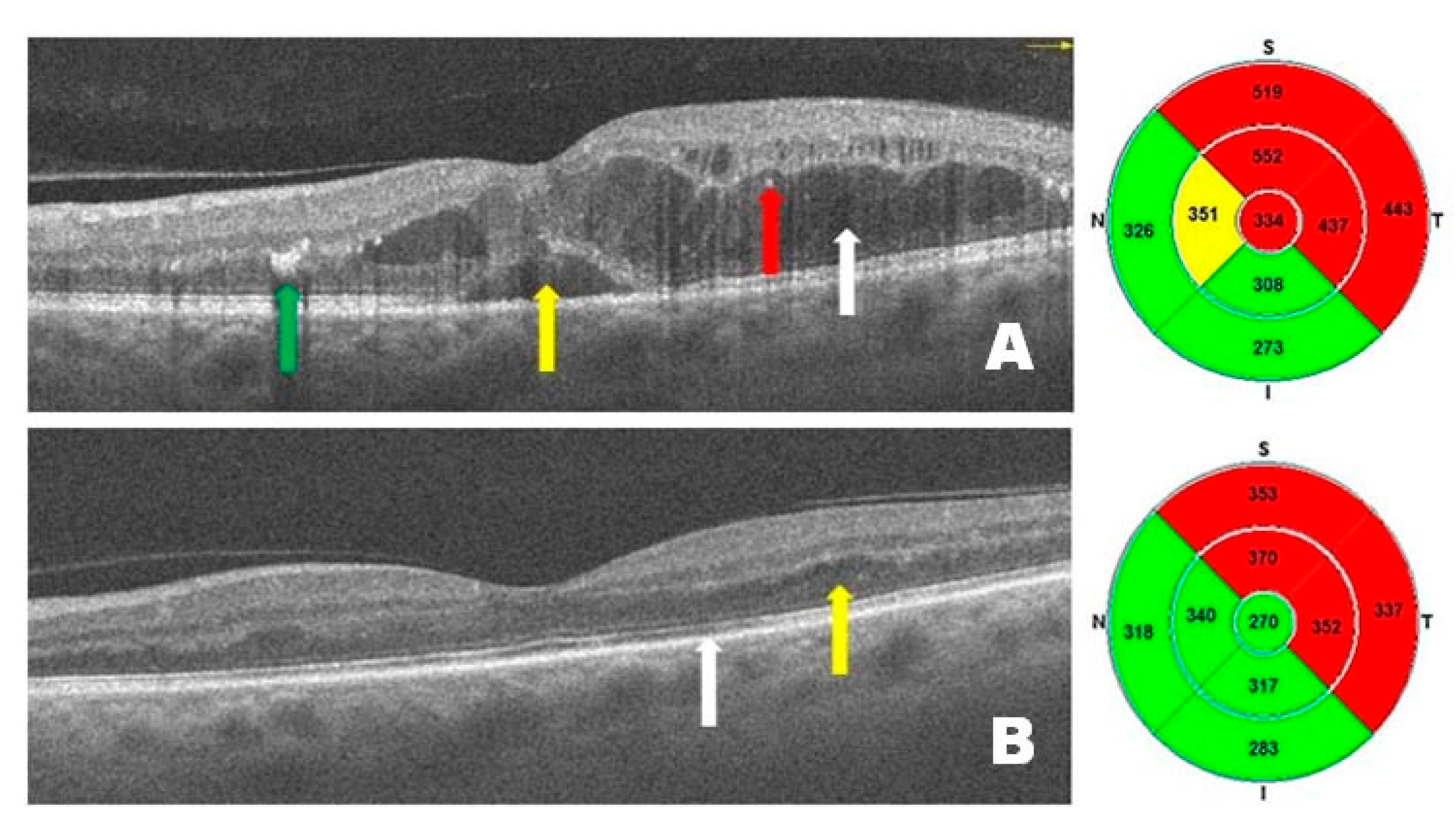 Pharmaceutics 17 00858 g002