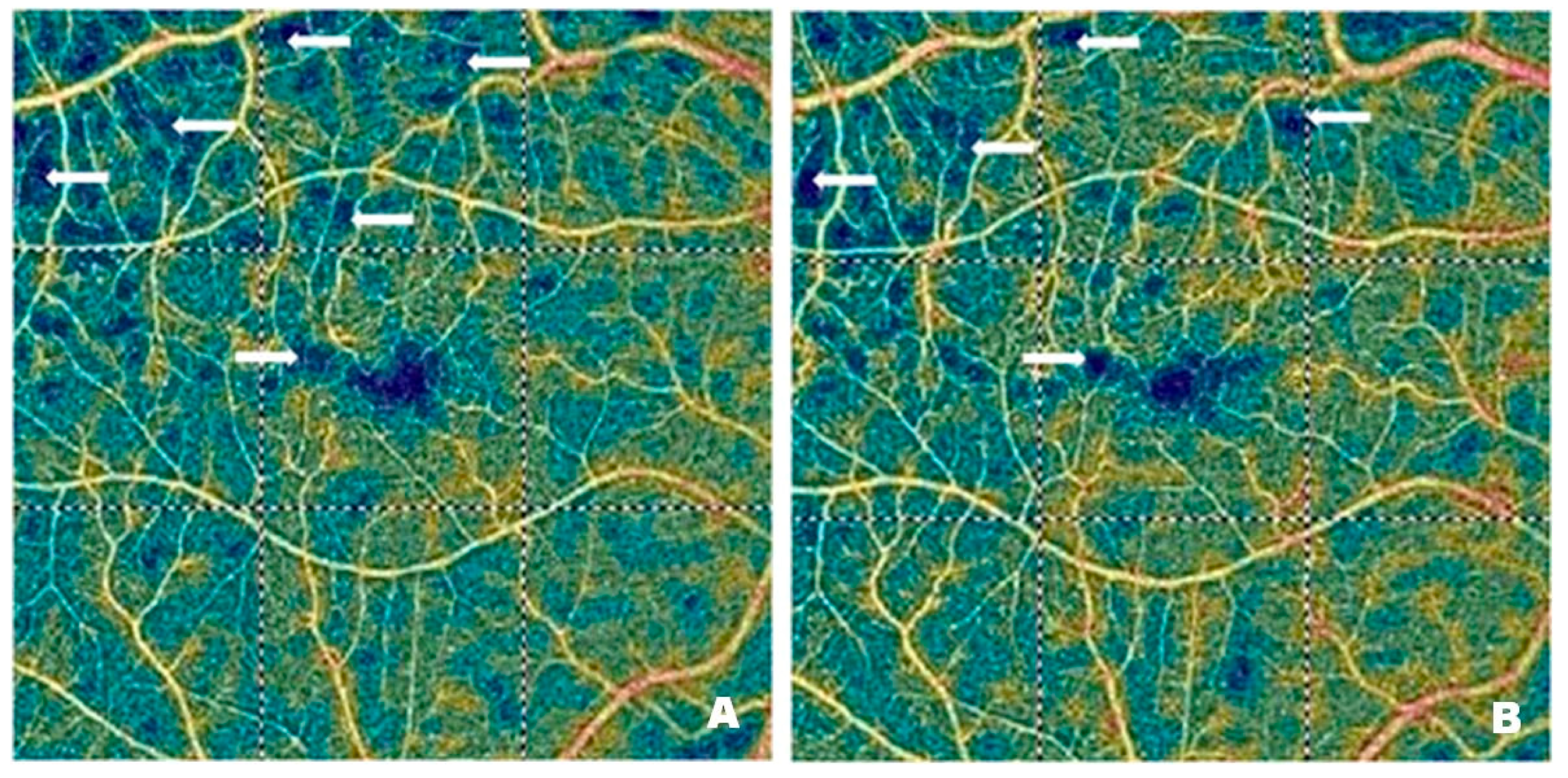 Pharmaceutics 17 00858 g004
