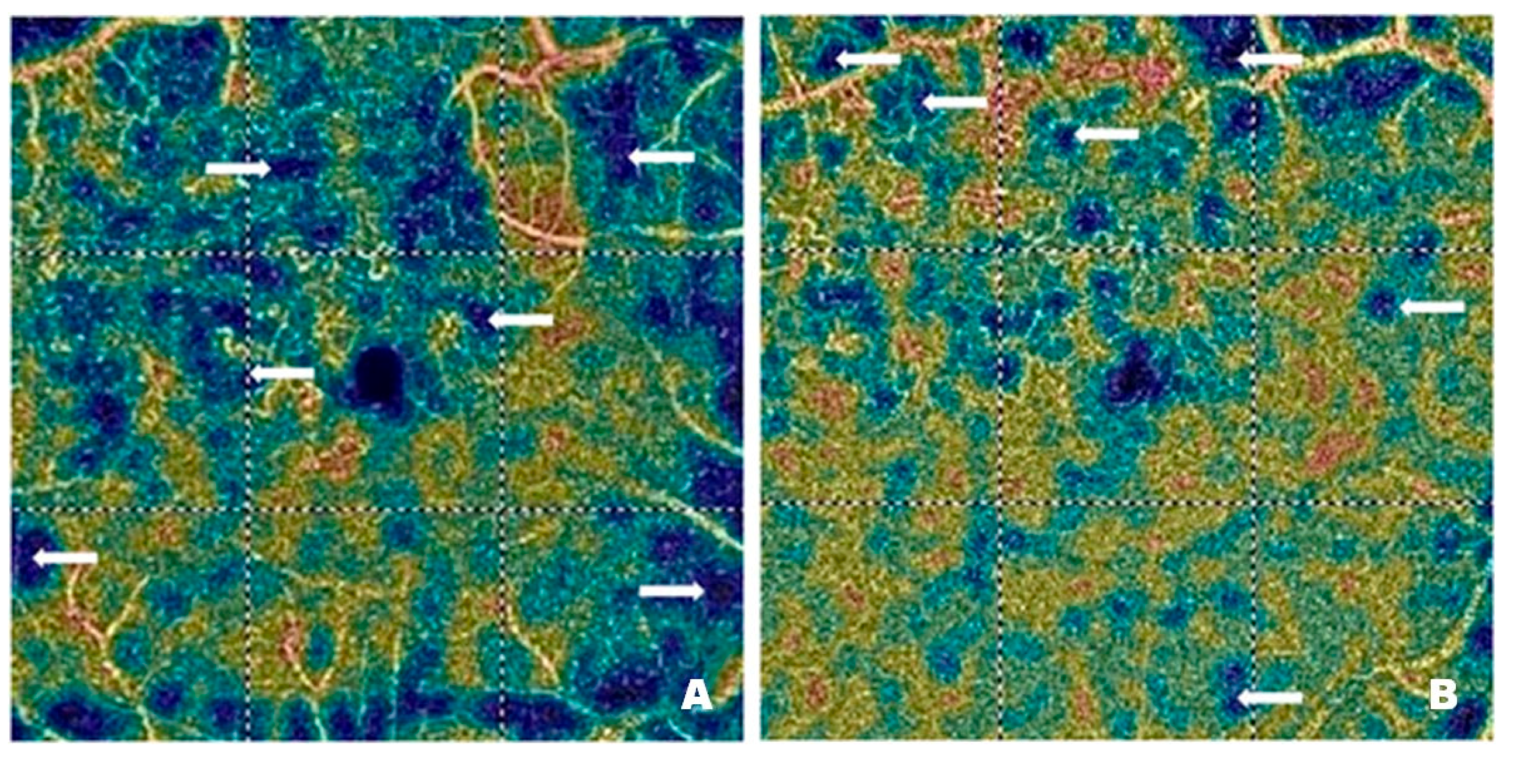 Pharmaceutics 17 00858 g006